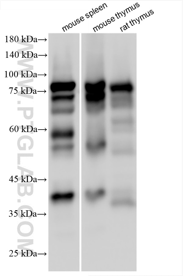 Western Blot (WB) analysis of various lysates using IL-16 Recombinant antibody (86421-1-RR)