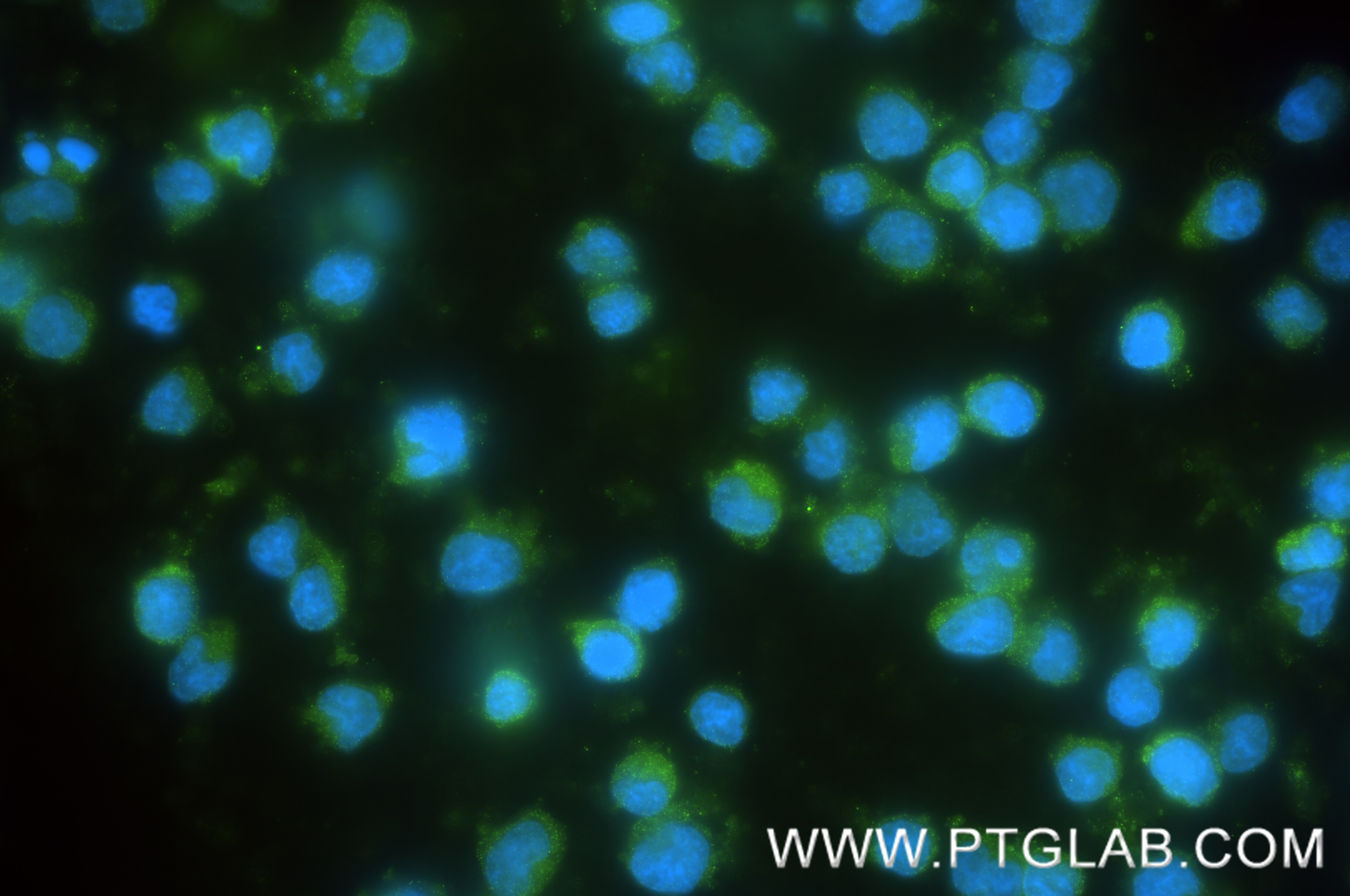 Immunofluorescence (IF) / fluorescent staining of Jurkat cells using IL-16 Recombinant monoclonal antibody (86927-2-RR)