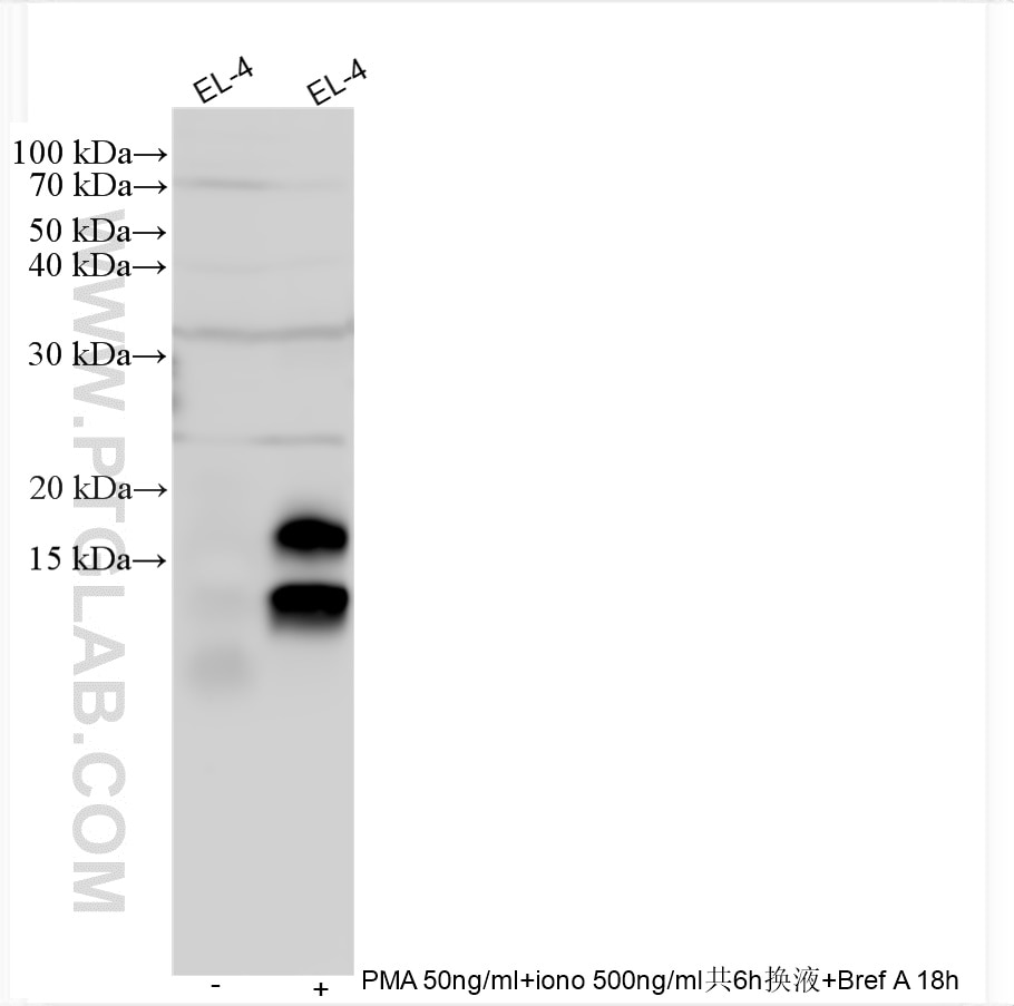 Western Blot (WB) analysis of various lysates using IL-17A Polyclonal antibody (30754-1-AP)