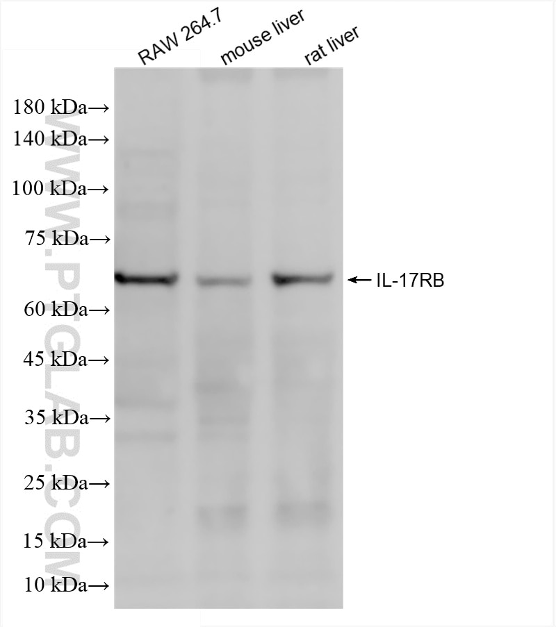Western Blot (WB) analysis of various lysates using IL-17RB Recombinant antibody (85961-1-RR)