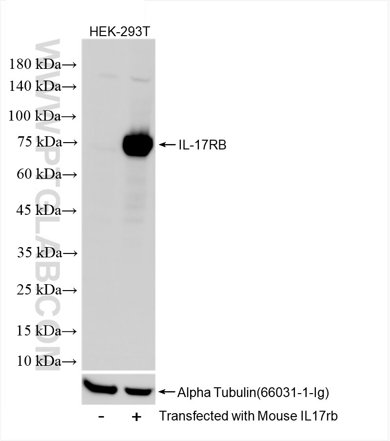 Western Blot (WB) analysis of Transfected HEK-293T cells using IL-17RB Recombinant antibody (85961-1-RR)