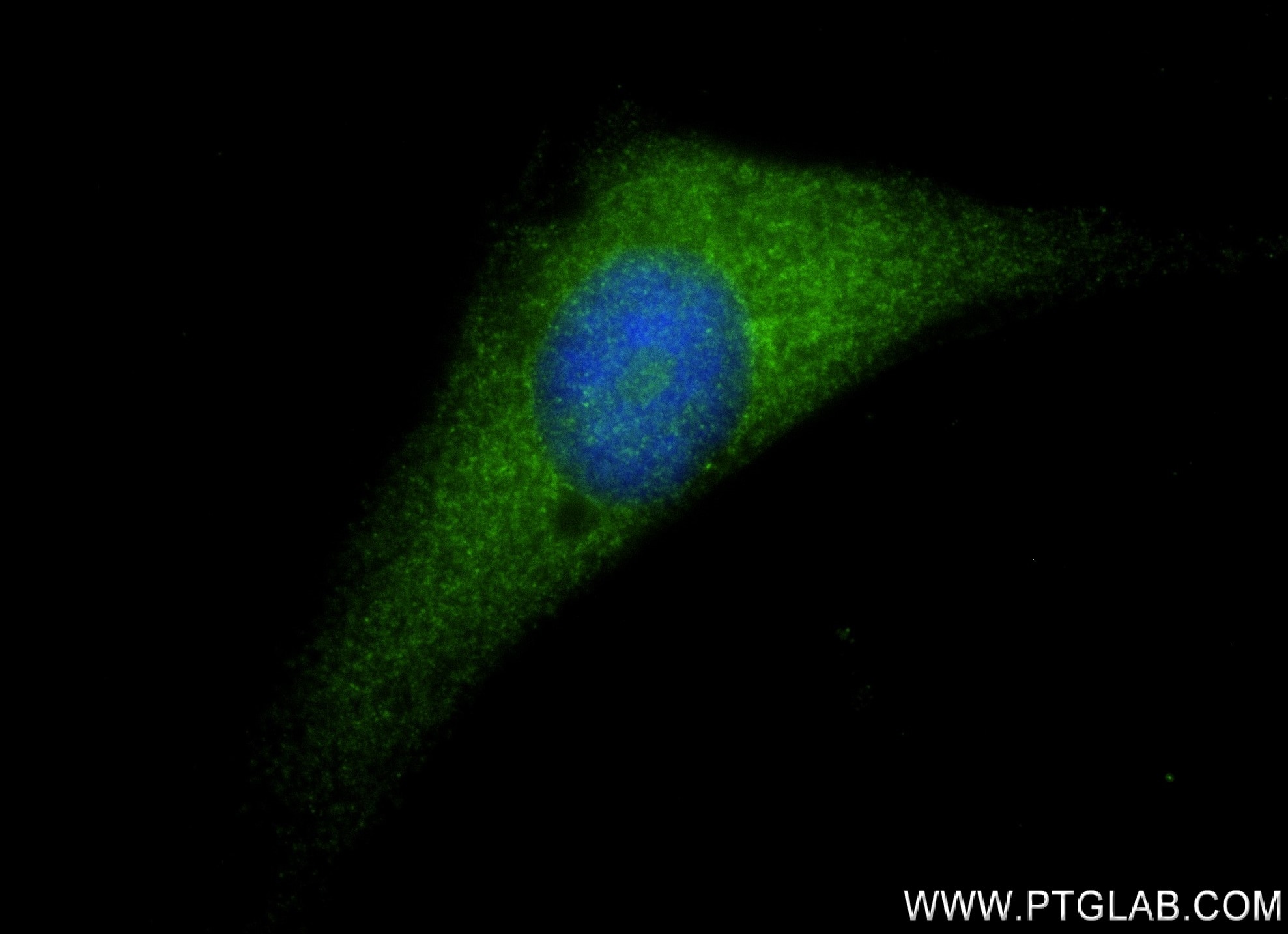 IF Staining of HeLa using 82907-1-RR