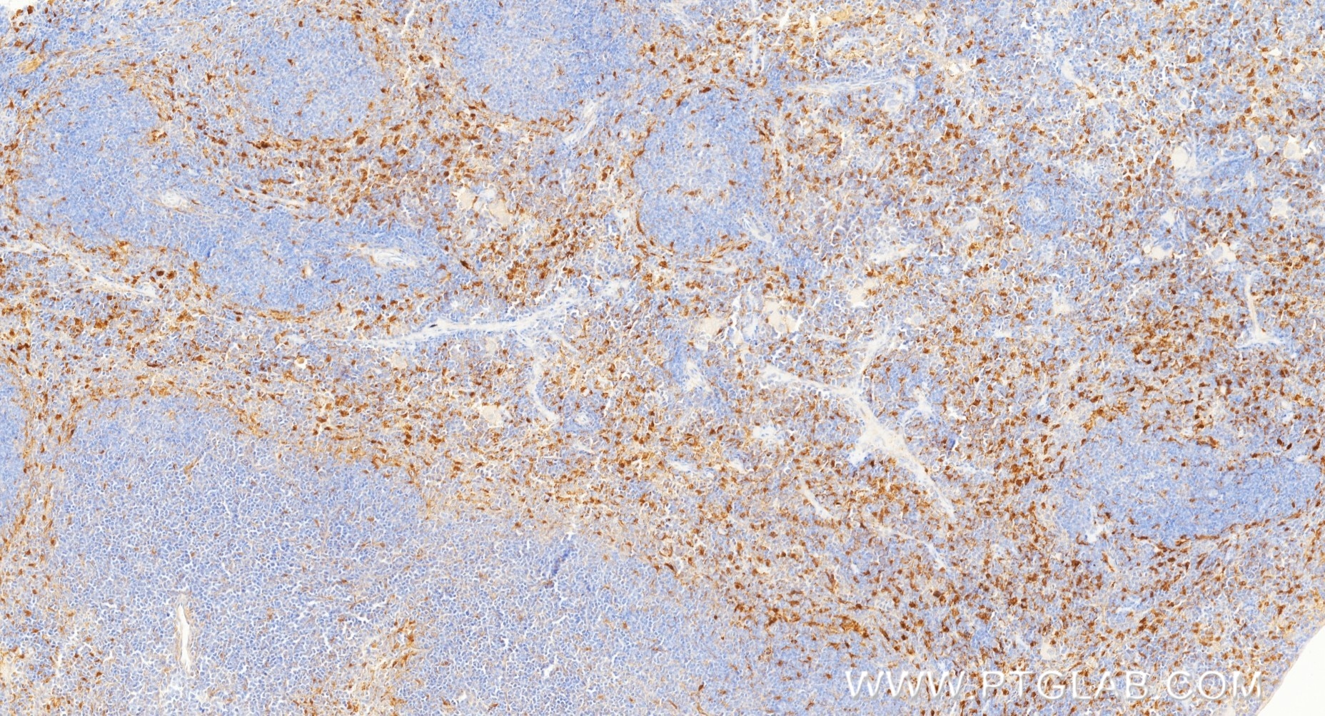 Immunohistochemistry (IHC) staining of mouse spleen tissue using IL-18 Recombinant monoclonal antibody (87348-2-RR)