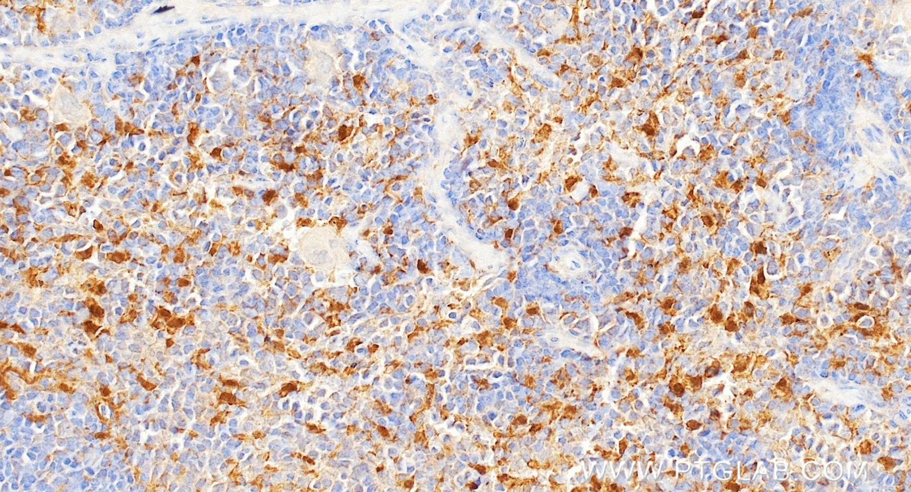 Immunohistochemistry (IHC) staining of mouse spleen tissue using IL-18 Recombinant monoclonal antibody (87348-2-RR)