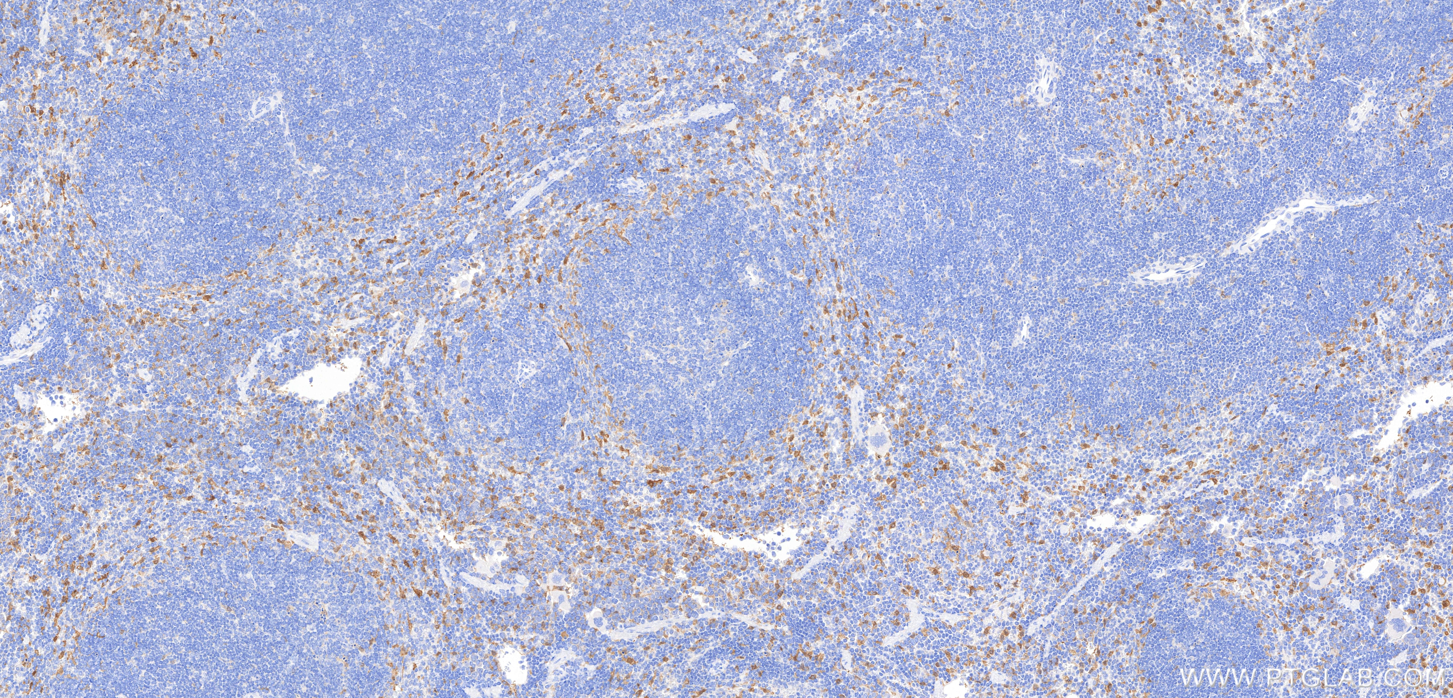IHC staining of mouse spleen using 98846-3-RR Immunohistochemistry (IHC) staining of mouse spleen tissue using Anti-Mouse IL-18 Rabbit Recombinant Antibody (98846-3-RR)