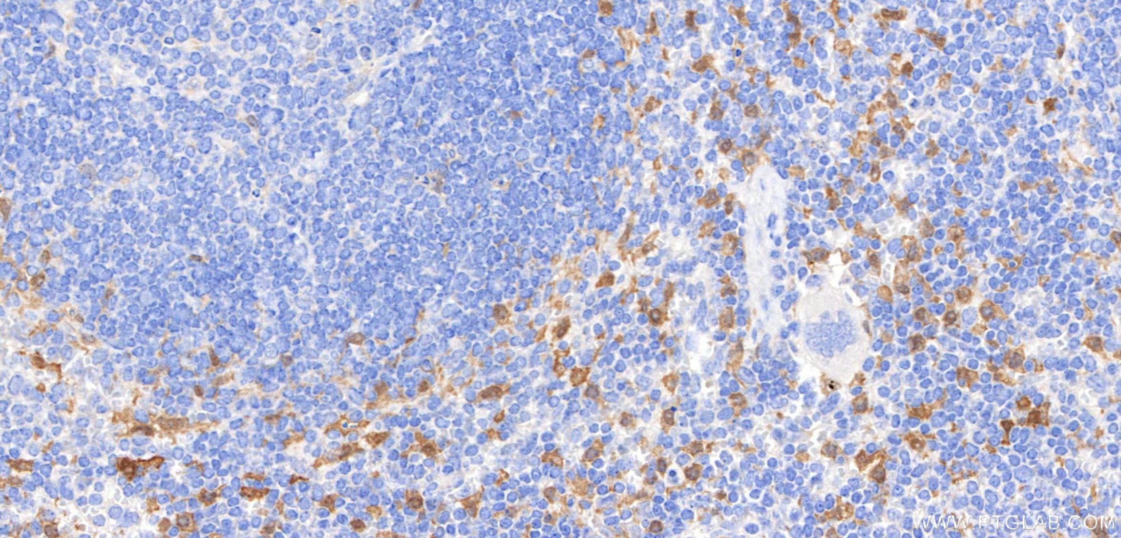 IHC staining of mouse spleen using 98846-3-RR Immunohistochemistry (IHC) staining of mouse spleen tissue using Anti-Mouse IL-18 Rabbit Recombinant Antibody (98846-3-RR)