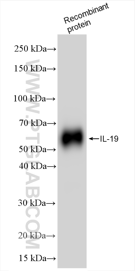 Western Blot (WB) analysis of various lysates using IL-19 Recombinant antibody (85817-2-RR)