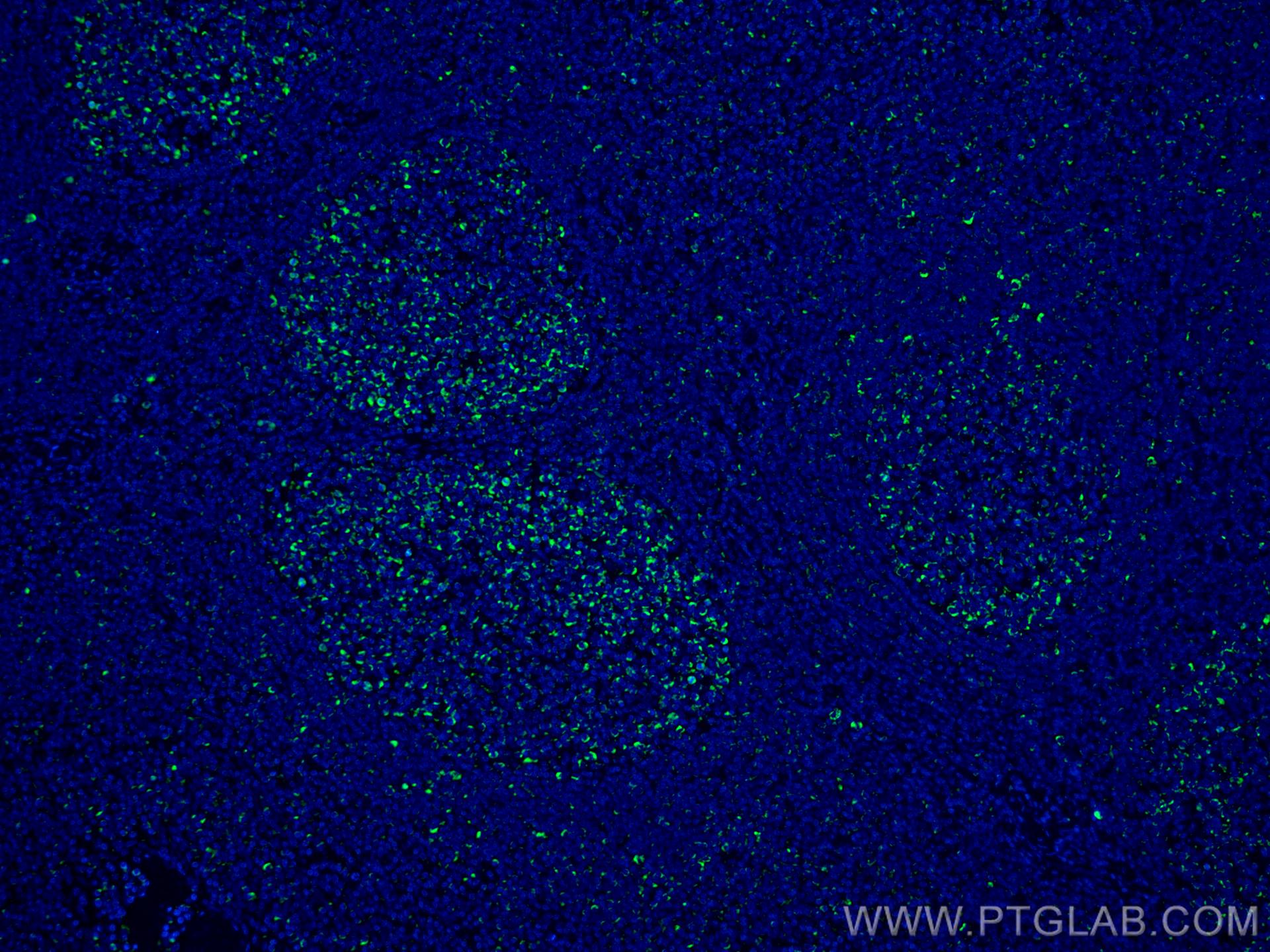 Immunofluorescence (IF) / fluorescent staining of human tonsillitis tissue using CoraLite® Plus 488-conjugated IL-19 Monoclonal ant (CL488-60278)