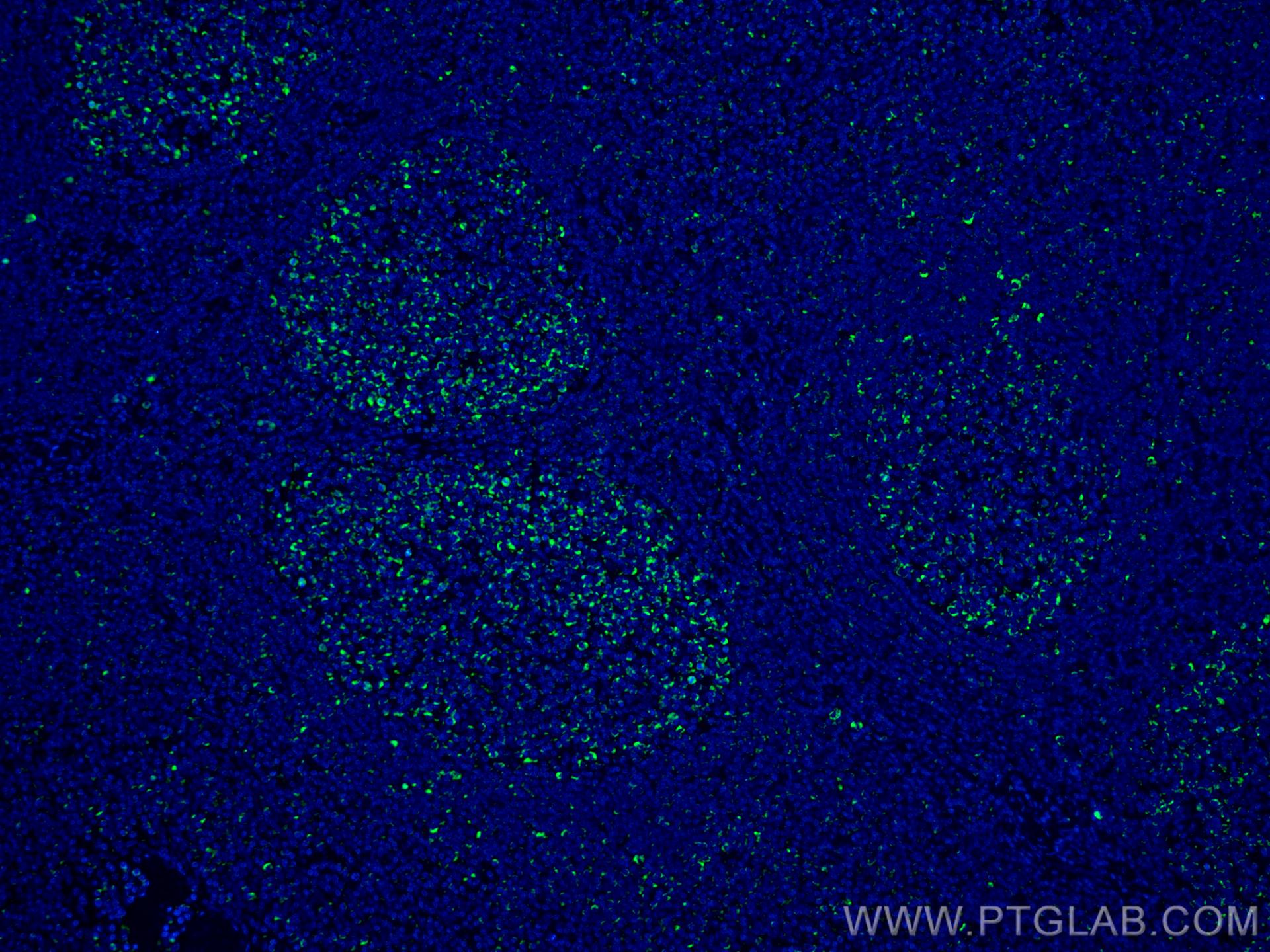 Immunofluorescence (IF) / fluorescent staining of human tonsillitis tissue using CoraLite® Plus 488-conjugated IL-19 Monoclonal ant (CL488-60278)