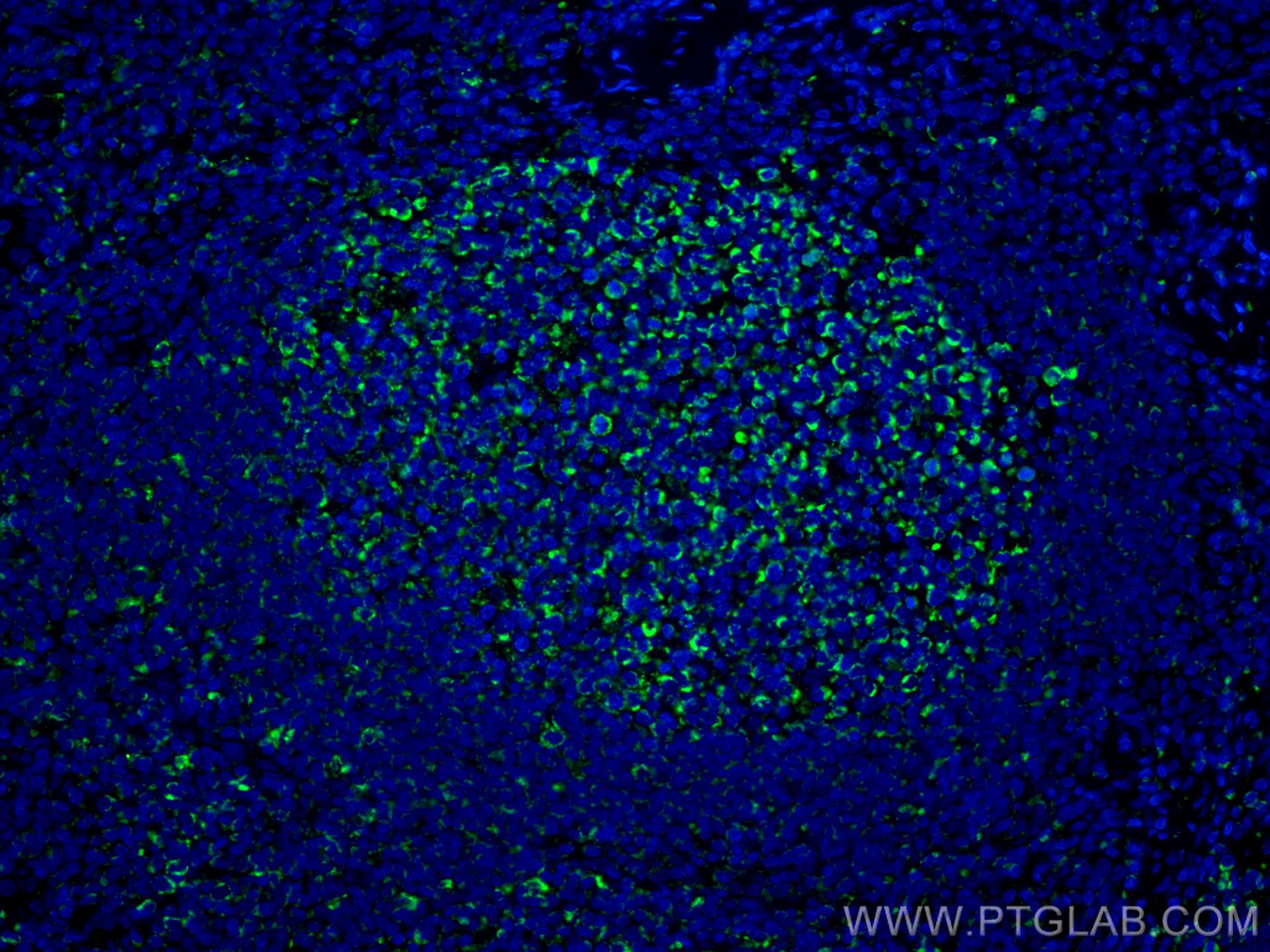 Immunofluorescence (IF) / fluorescent staining of human tonsillitis tissue using CoraLite® Plus 488-conjugated IL-19 Monoclonal ant (CL488-60278)