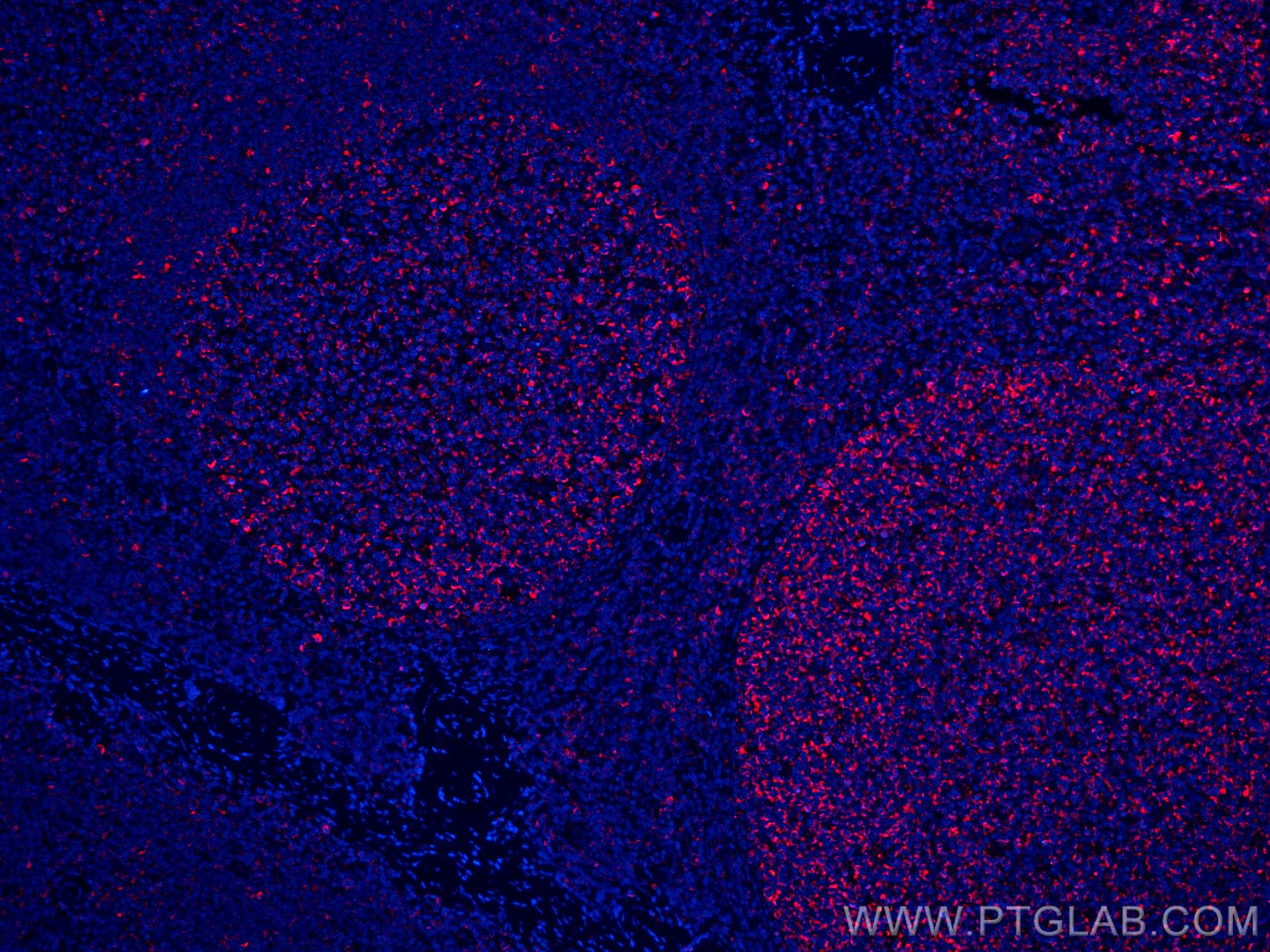 Immunofluorescence (IF) / fluorescent staining of human tonsillitis tissue using CoraLite®594-conjugated IL-19 Monoclonal antibody (CL594-60278)