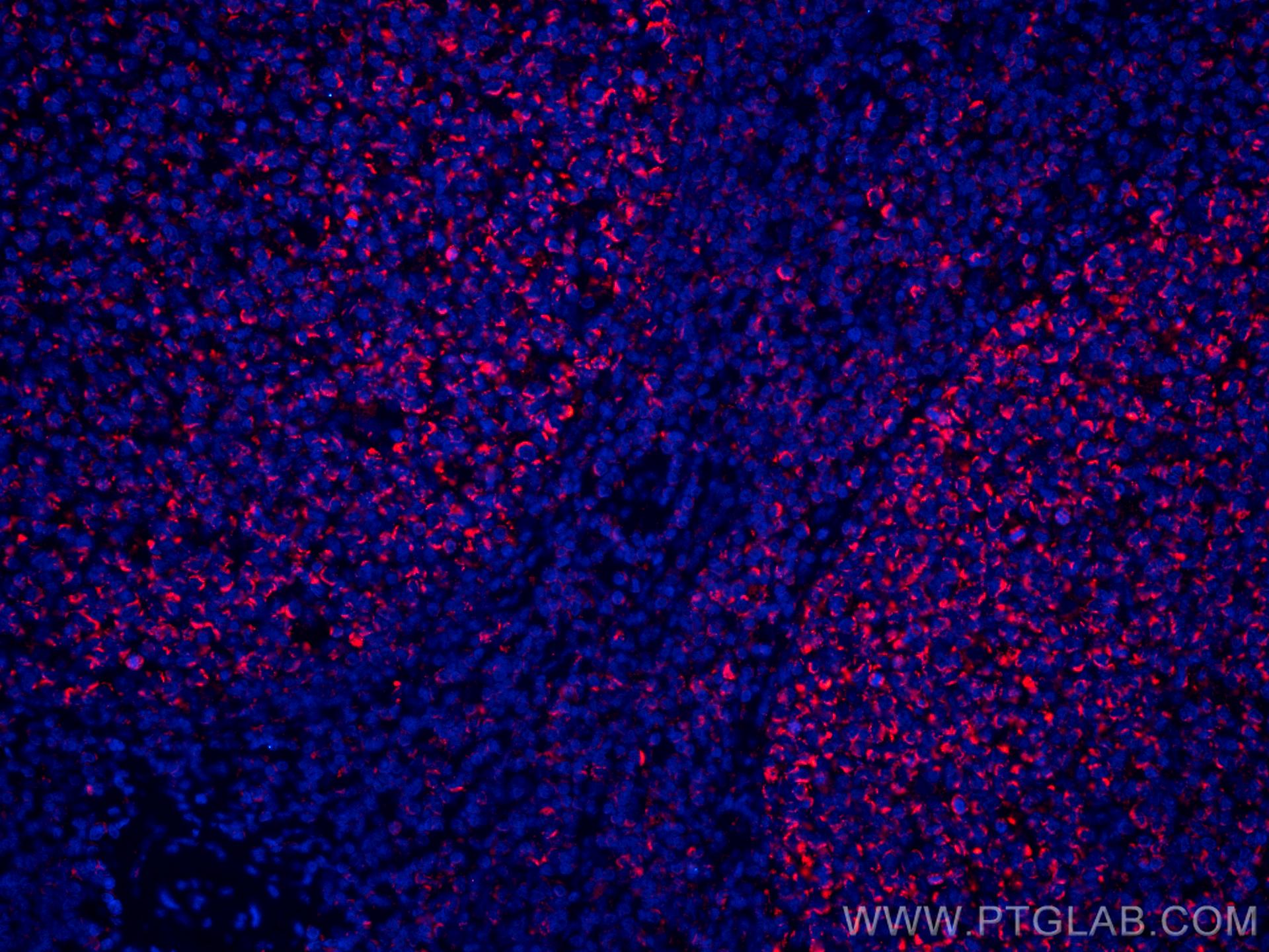 Immunofluorescence (IF) / fluorescent staining of human tonsillitis tissue using CoraLite®594-conjugated IL-19 Monoclonal antibody (CL594-60278)