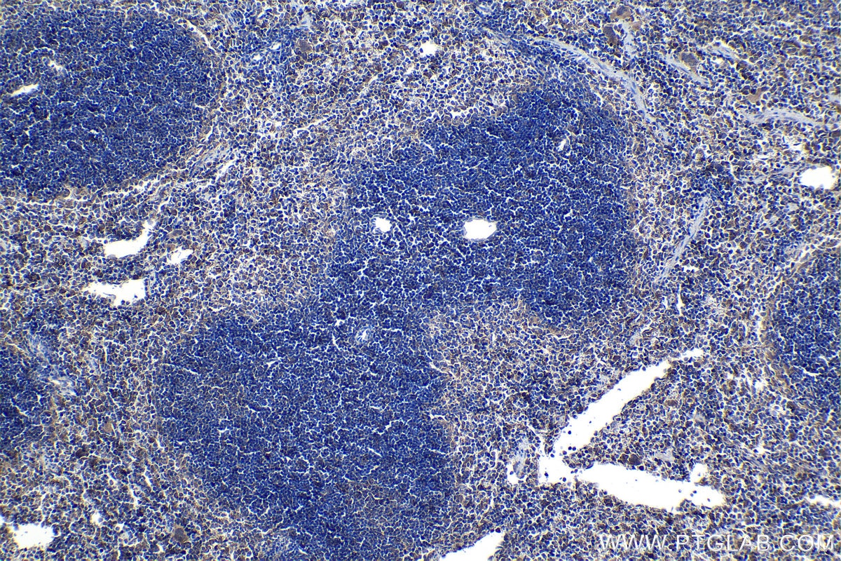 Immunohistochemistry (IHC) staining of mouse spleen tissue using IL-1R1 Polyclonal antibody (27348-1-AP)