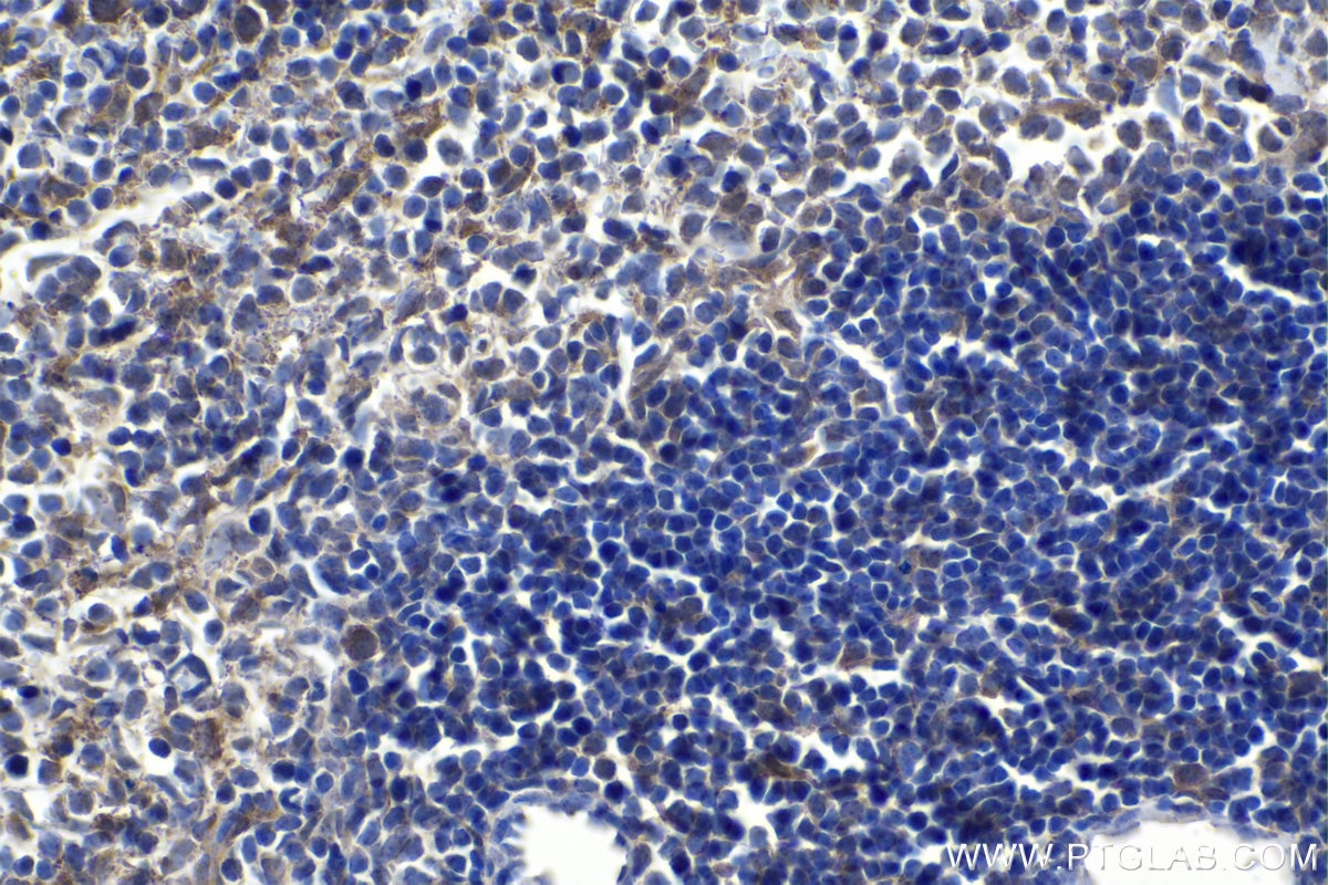 Immunohistochemistry (IHC) staining of mouse spleen tissue using IL-1R1 Polyclonal antibody (27348-1-AP)