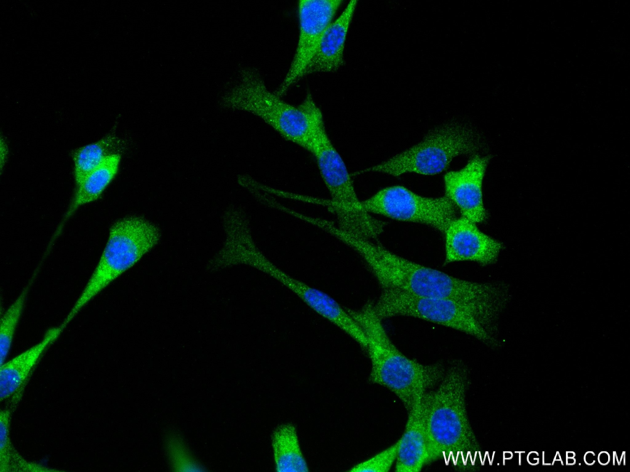 Immunofluorescence (IF) / fluorescent staining of NIH/3T3 cells using IL-1R1 Recombinant antibody (84094-6-RR)