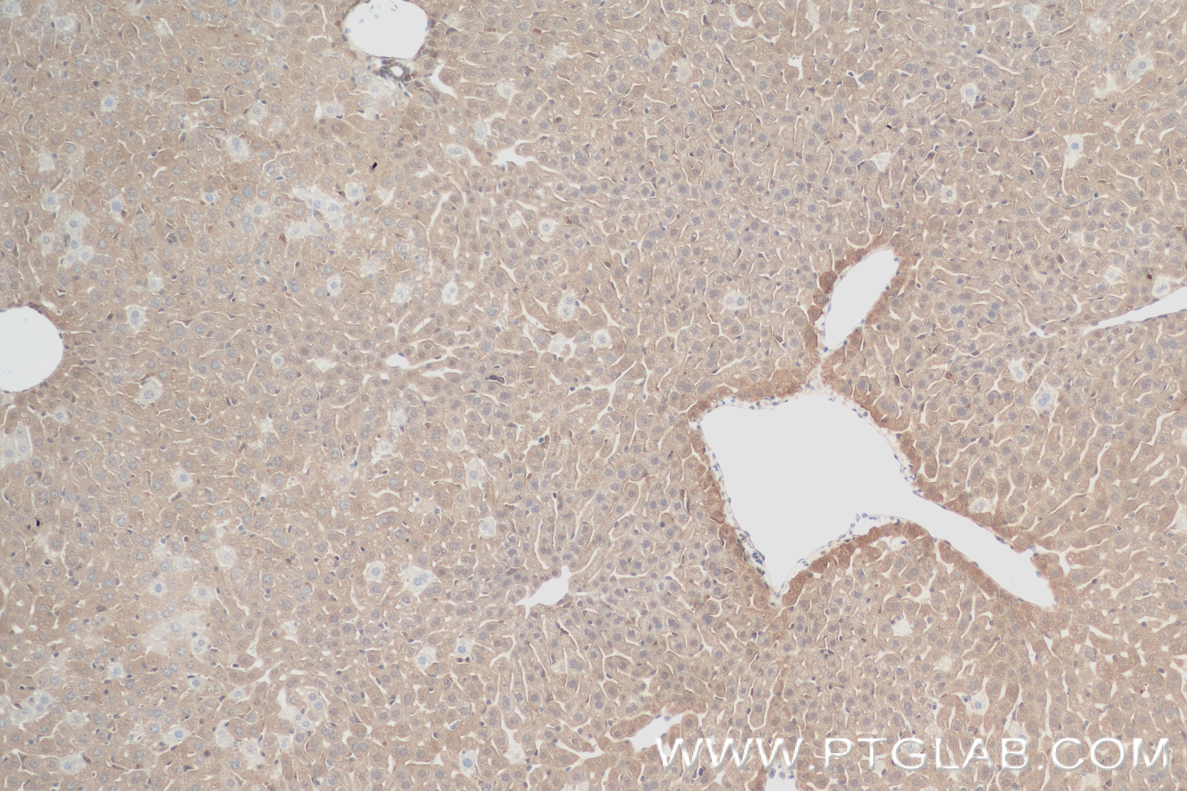 Immunohistochemistry (IHC) staining of mouse liver tissue using IL-1R1 Recombinant antibody (84094-6-RR)