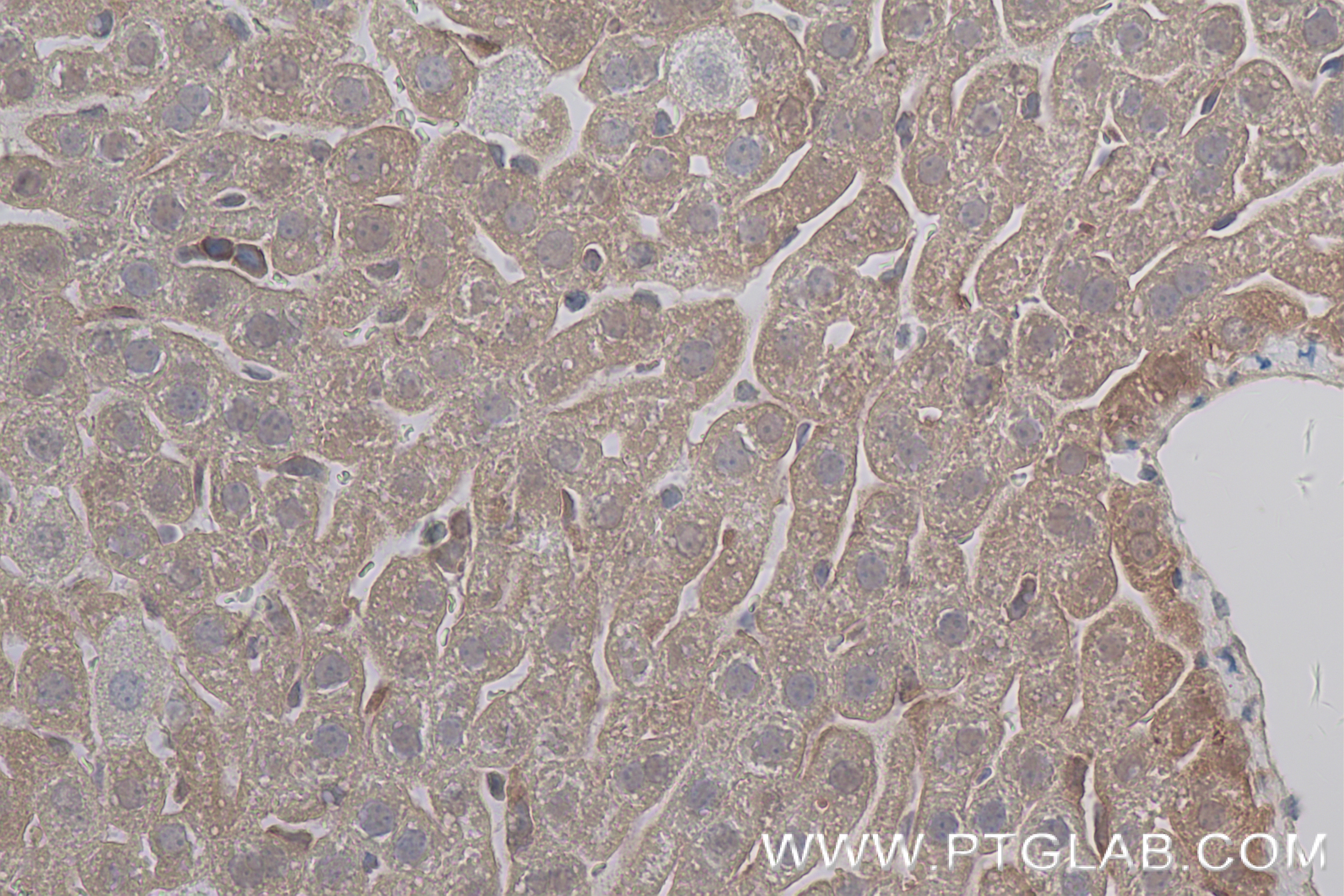 Immunohistochemistry (IHC) staining of mouse liver tissue using IL-1R1 Recombinant antibody (84094-6-RR)