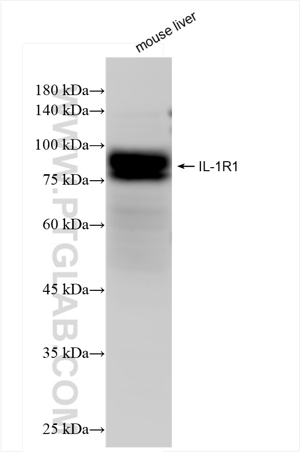 Western Blot (WB) analysis of mouse liver tissue using IL-1R1 Recombinant antibody (84094-6-RR)