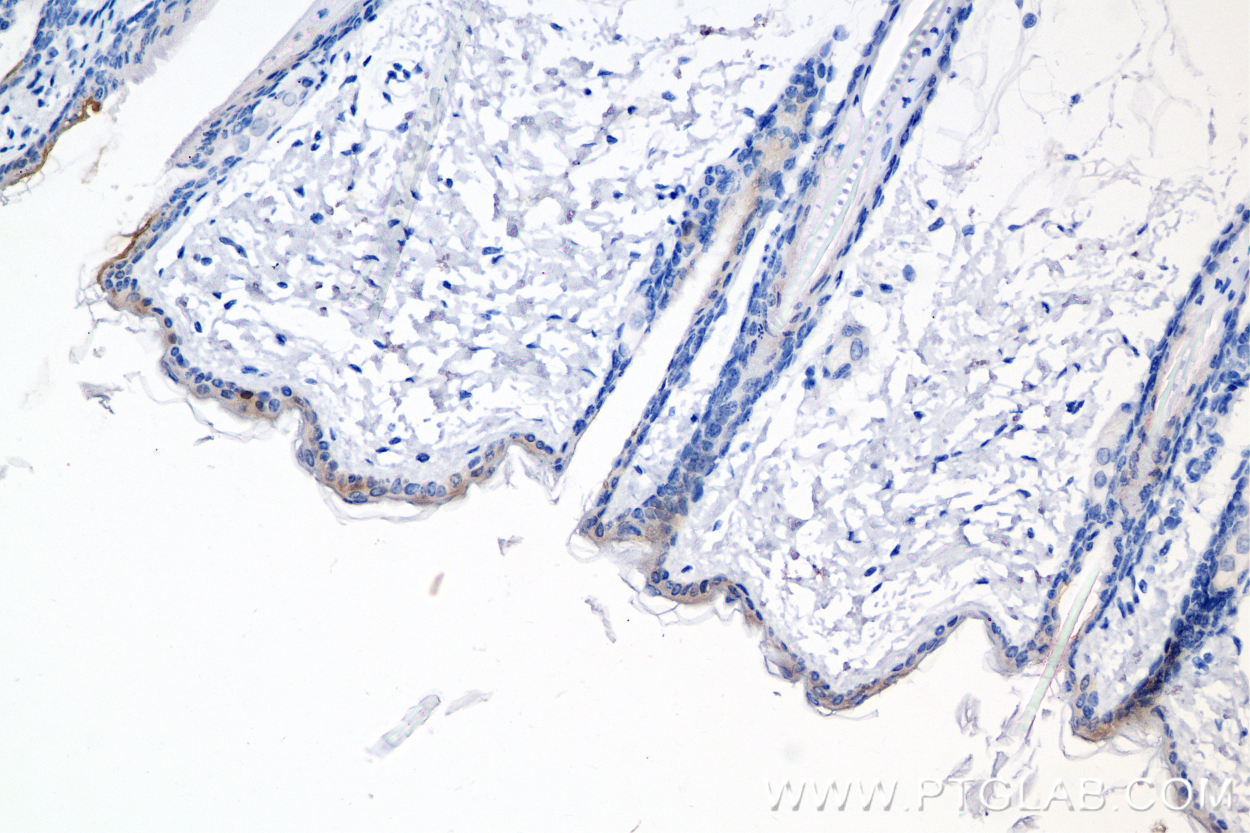 Immunohistochemistry (IHC) staining of mouse skin tissue using IL-1RA/IL-1RN Recombinant antibody (85672-3-RR)