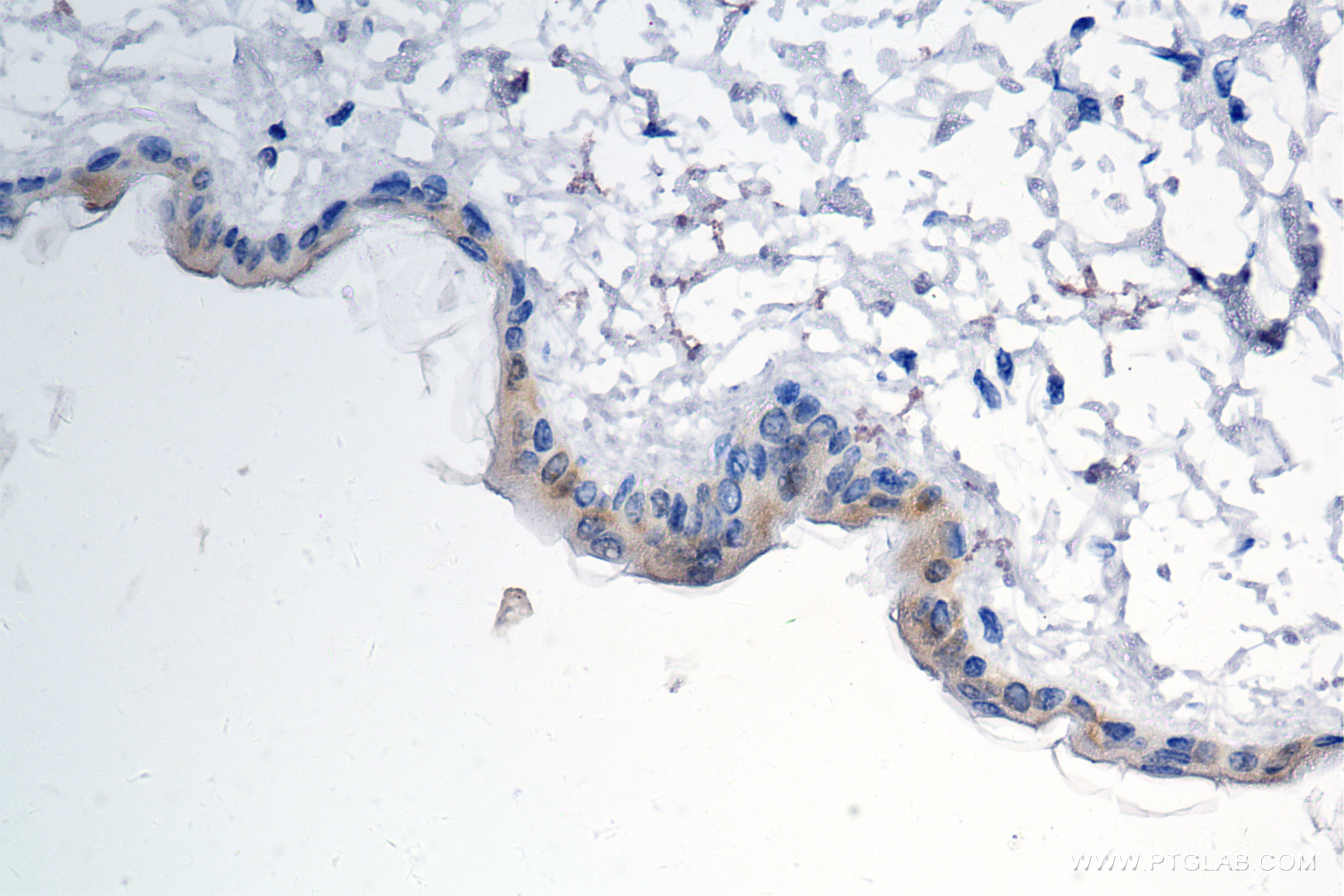 Immunohistochemistry (IHC) staining of mouse skin tissue using IL-1RA/IL-1RN Recombinant antibody (85672-3-RR)