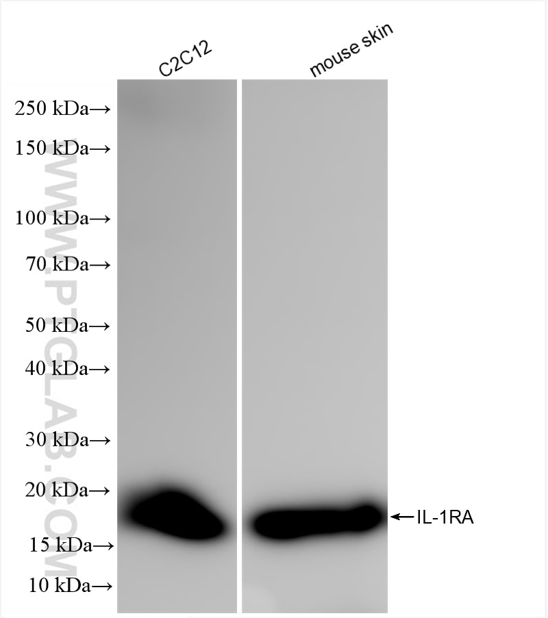 Western Blot (WB) analysis of various lysates using IL-1RA/IL-1RN Recombinant antibody (85672-3-RR)