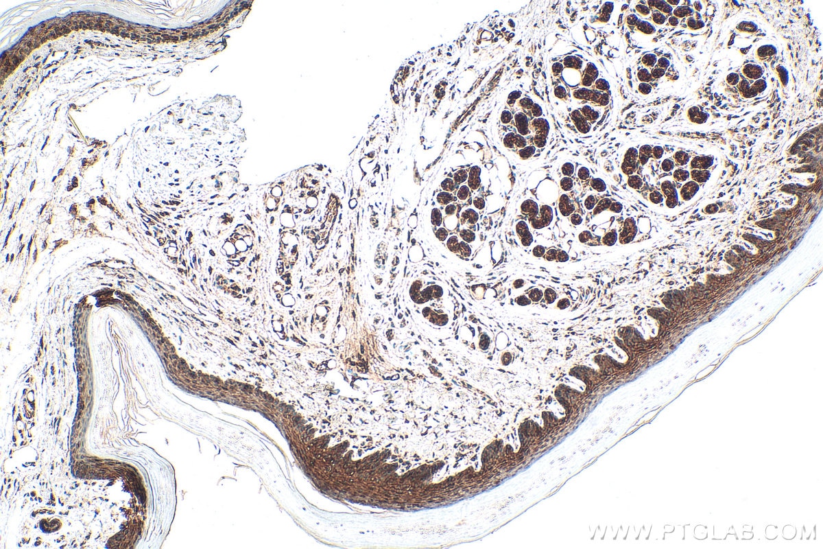 Immunohistochemistry (IHC) staining of mouse skin tissue using IL-1RA  Polyclonal antibody (31127-1-AP)