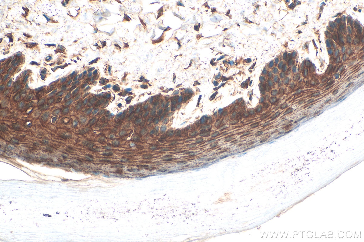 Immunohistochemistry (IHC) staining of mouse skin tissue using IL-1RA  Polyclonal antibody (31127-1-AP)