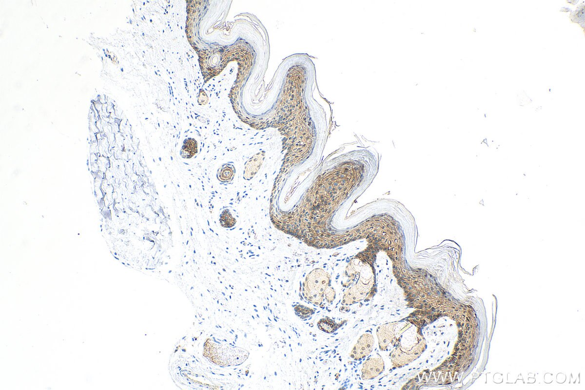 Immunohistochemistry (IHC) staining of mouse skin tissue using IL-1RA  Recombinant antibody (83335-4-RR)