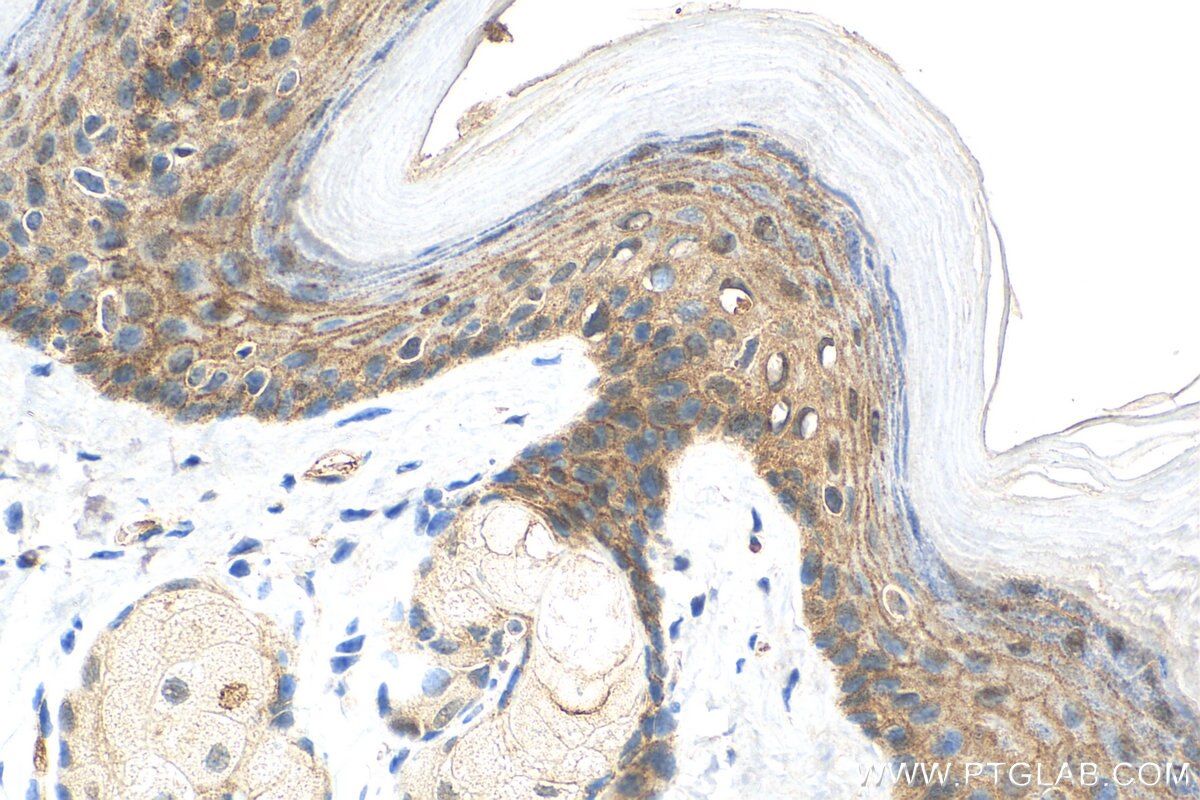 Immunohistochemistry (IHC) staining of mouse skin tissue using IL-1RA  Recombinant antibody (83335-4-RR)