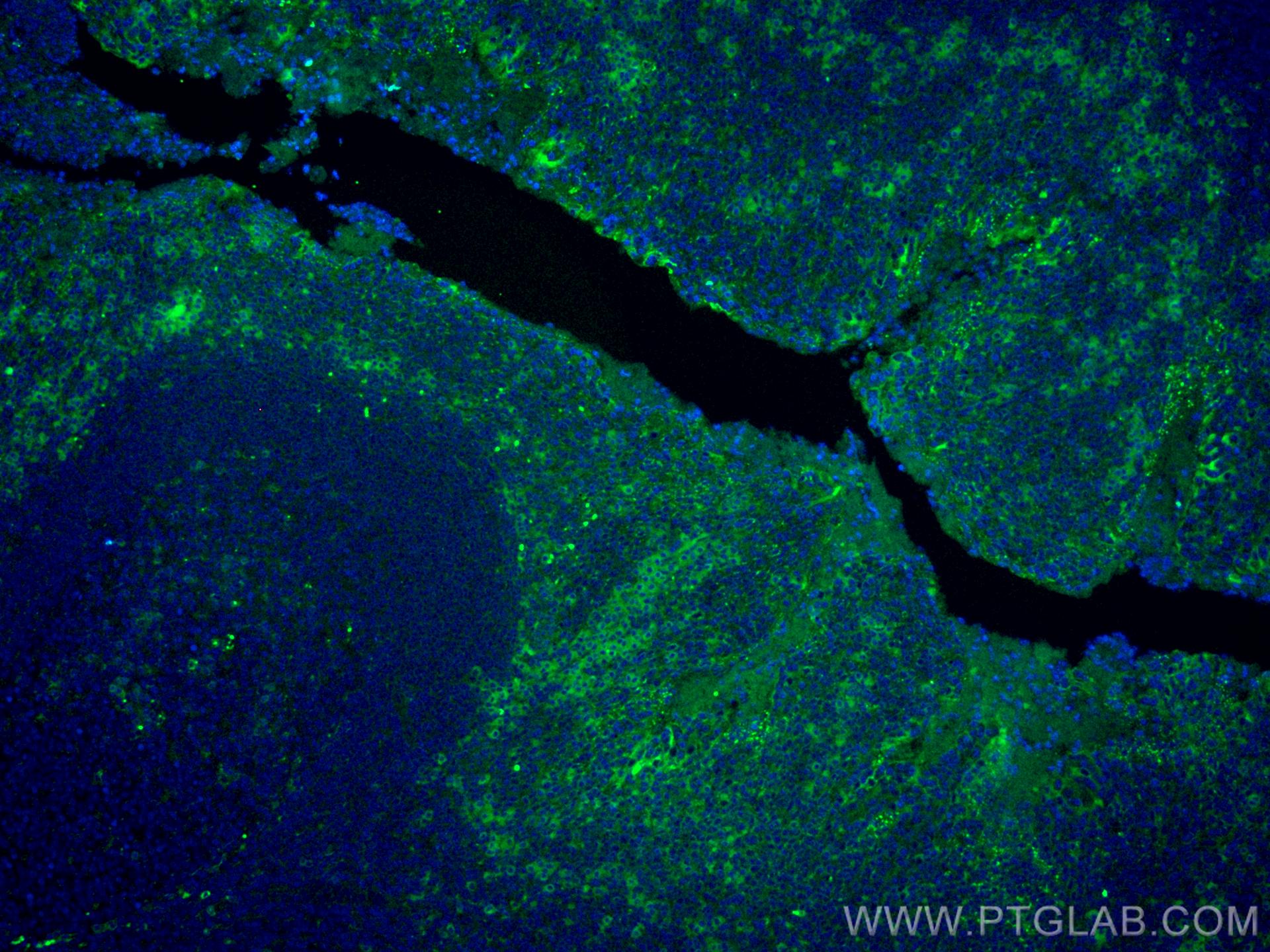 Immunofluorescence (IF) / fluorescent staining of human tonsillitis tissue using CoraLite® Plus 488-conjugated IL-2 Monoclonal anti (CL488-60306)