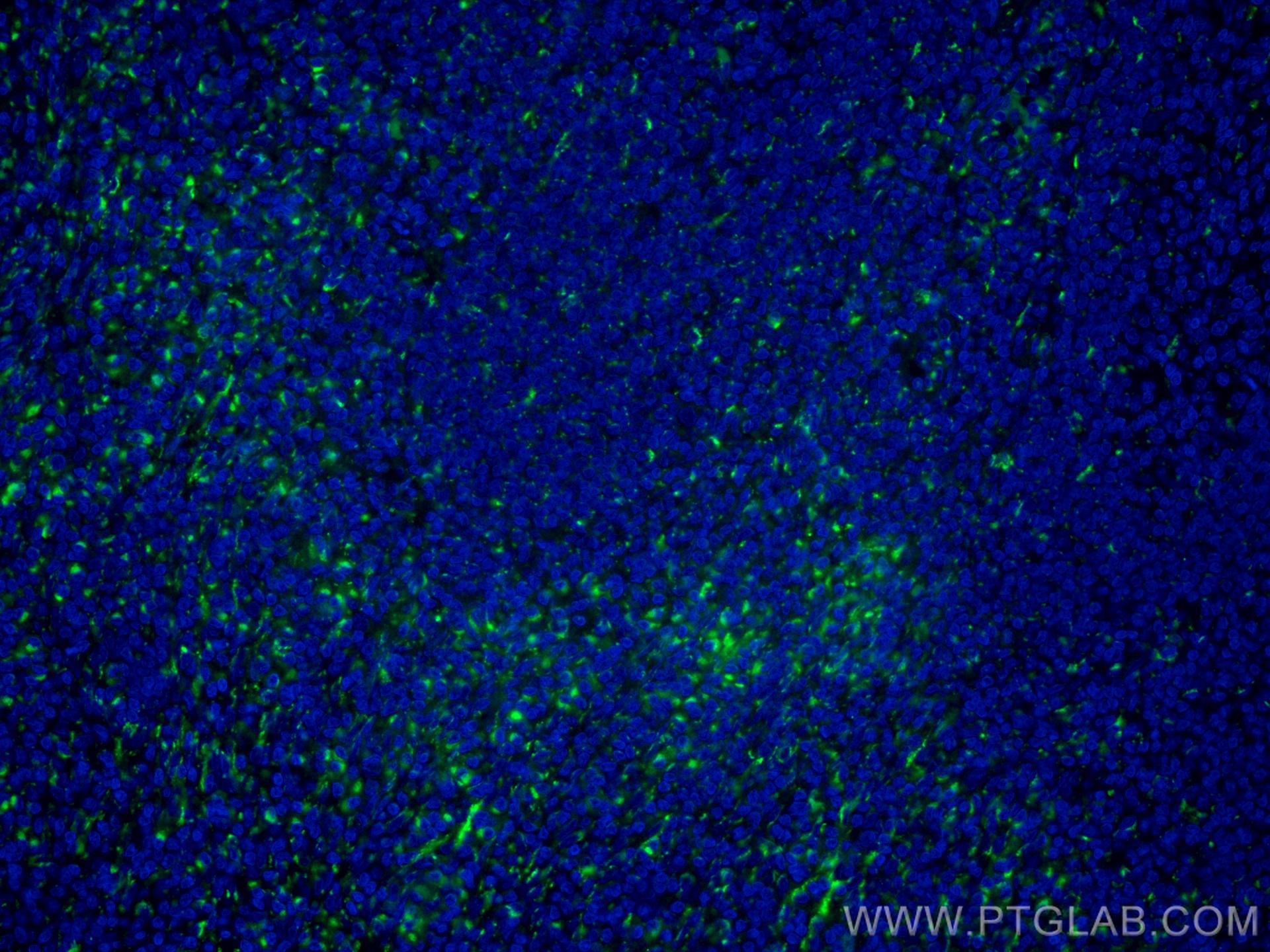 Immunofluorescence (IF) / fluorescent staining of human tonsillitis tissue using CoraLite® Plus 488-conjugated IL-2 Monoclonal anti (CL488-60306)