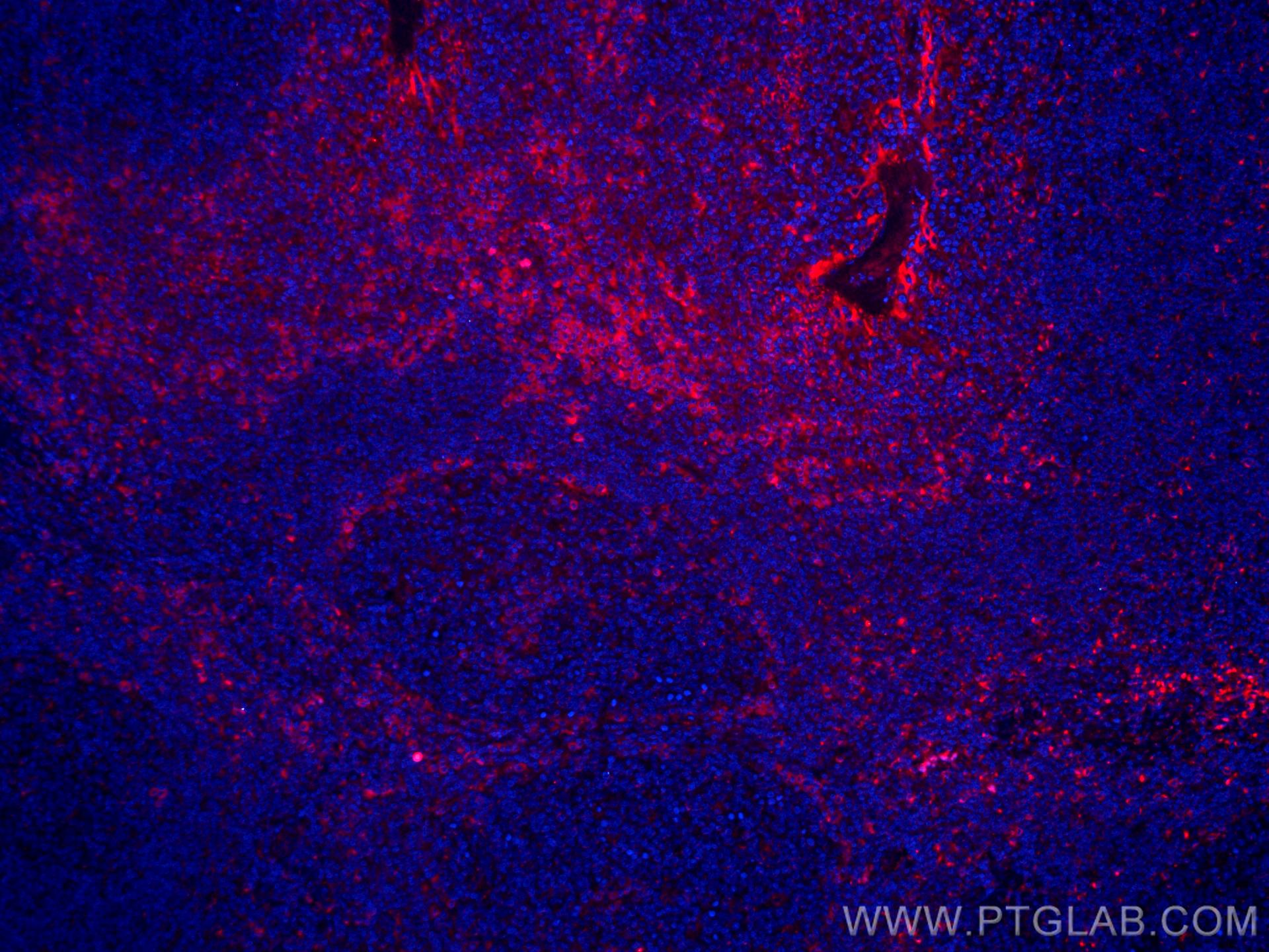 Immunofluorescence (IF) / fluorescent staining of human tonsillitis tissue using CoraLite®594-conjugated IL-2 Monoclonal antibody (CL594-60306)