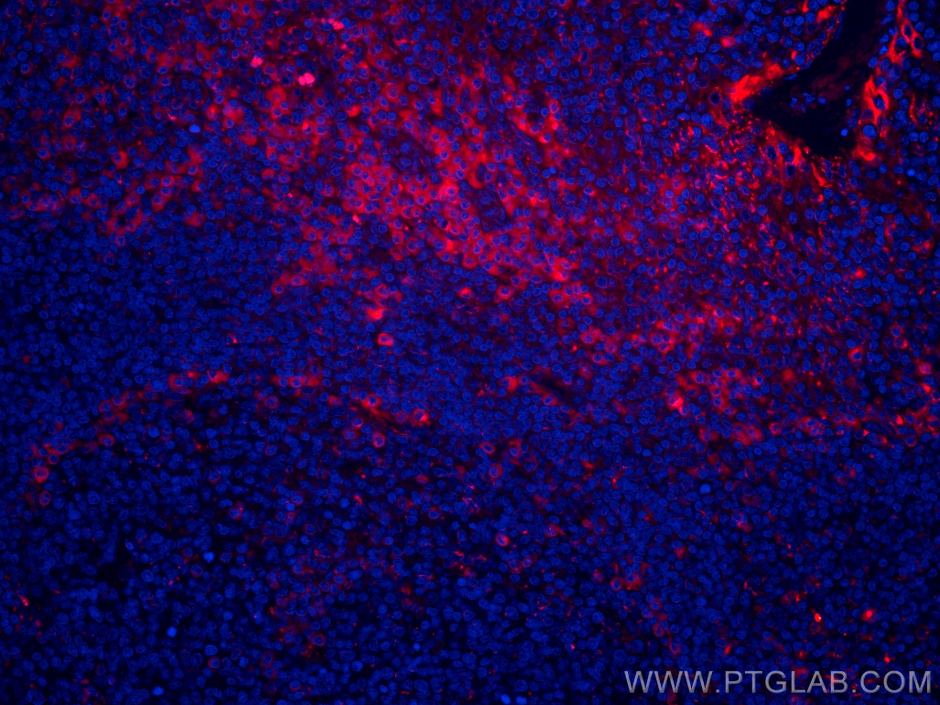 IF Staining of human tonsillitis using CL594-60306