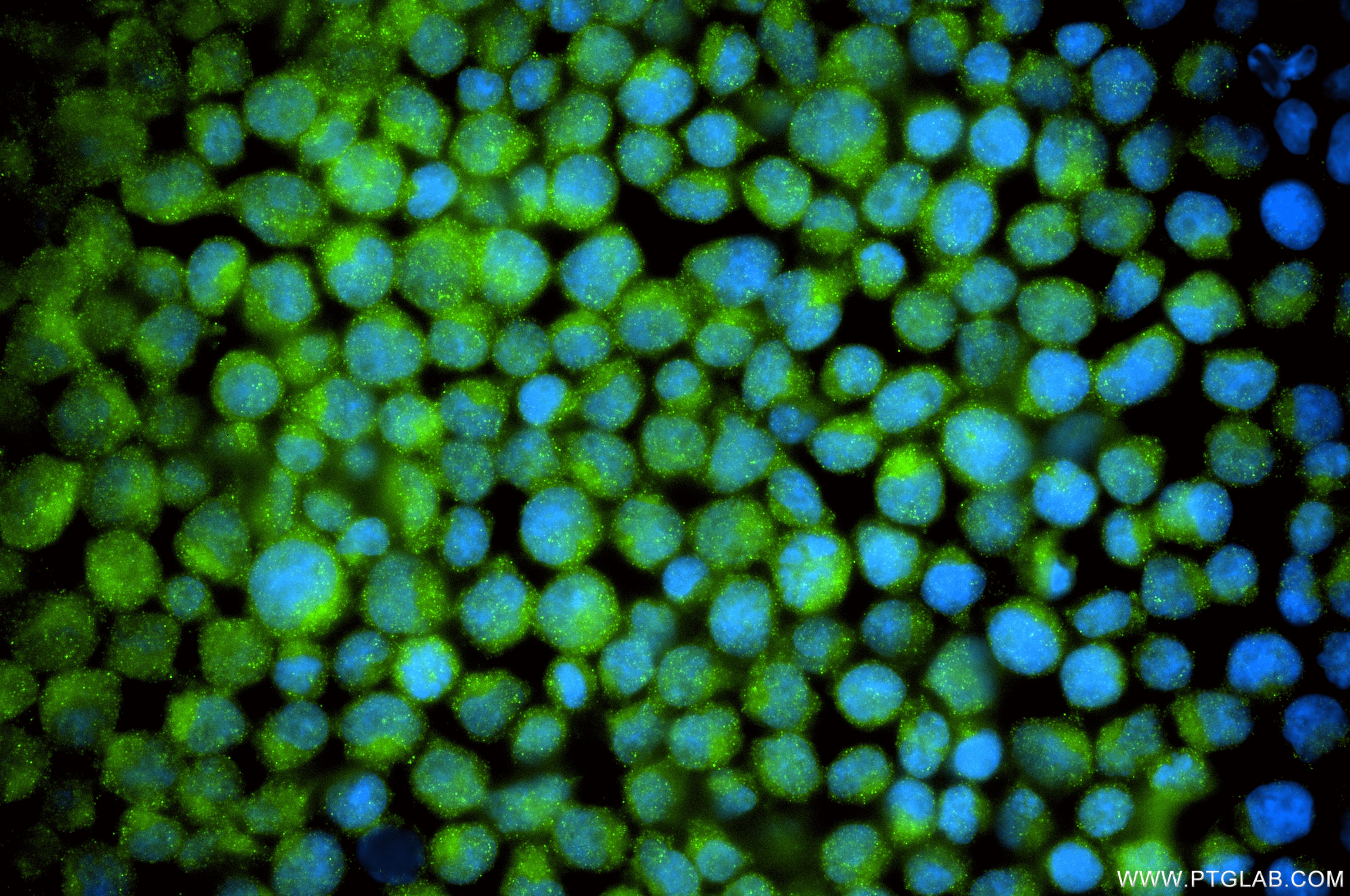 IF Staining of Jurkat using 87821-1-RR (same clone as 87821-1-PBS) Immunofluorescence (IF) / fluorescent staining of Jurkat cells using IL-24 Recombinant monoclonal antibody (87821-1-RR)