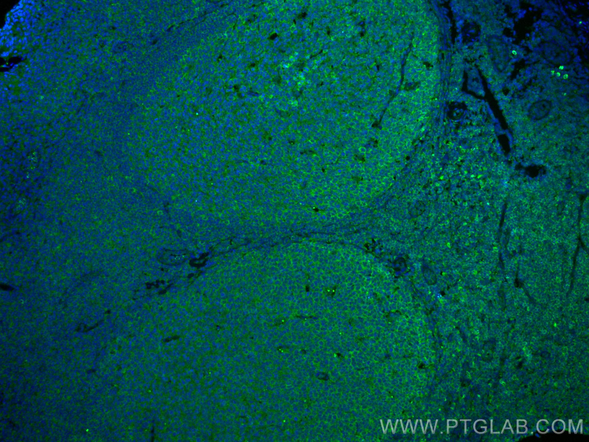 Immunofluorescence (IF) / fluorescent staining of human tonsillitis tissue using CoraLite® Plus 488-conjugated IL-28A Monoclonal an (CL488-60270)