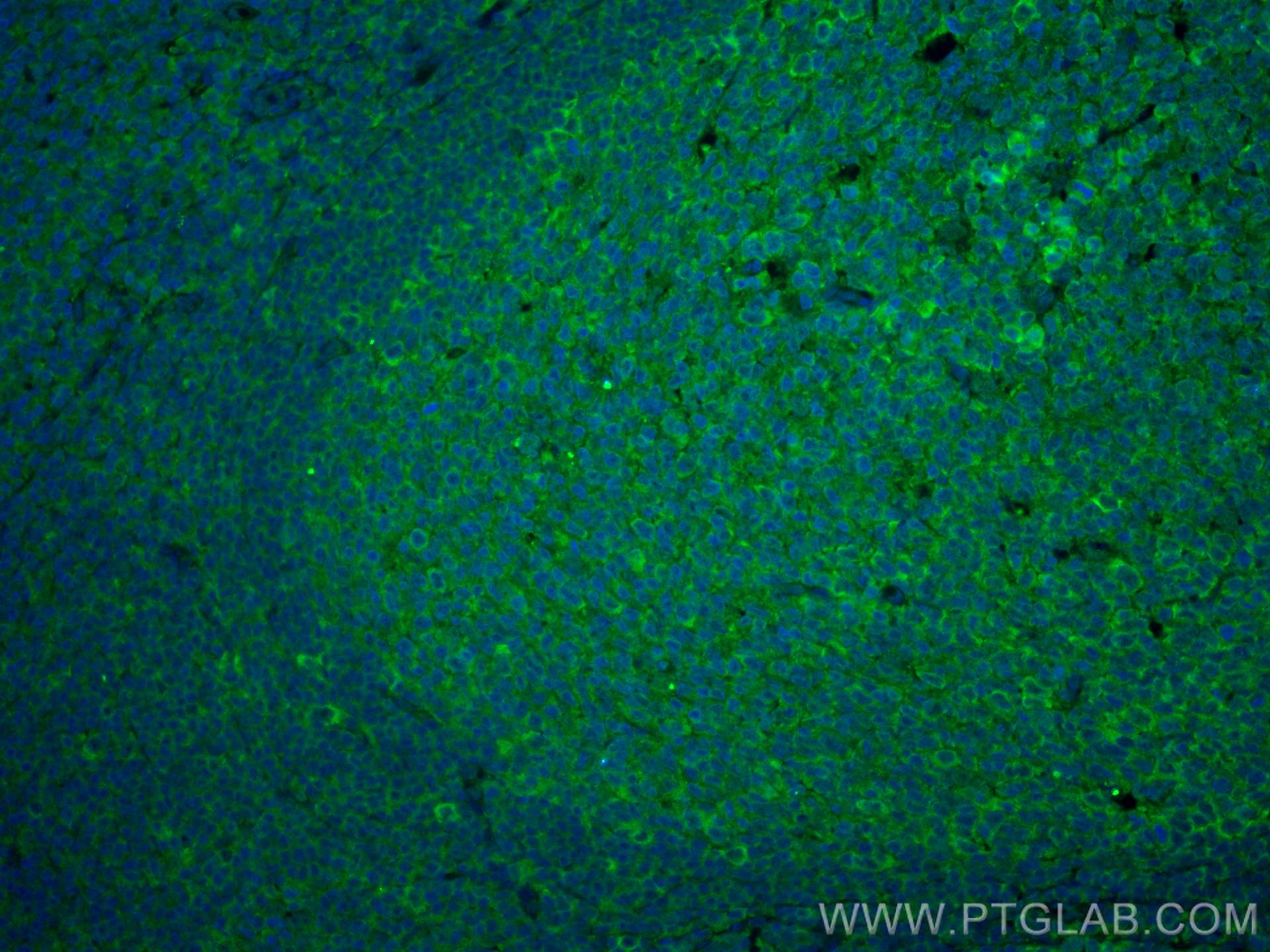 Immunofluorescence (IF) / fluorescent staining of human tonsillitis tissue using CoraLite® Plus 488-conjugated IL-28A Monoclonal an (CL488-60270)