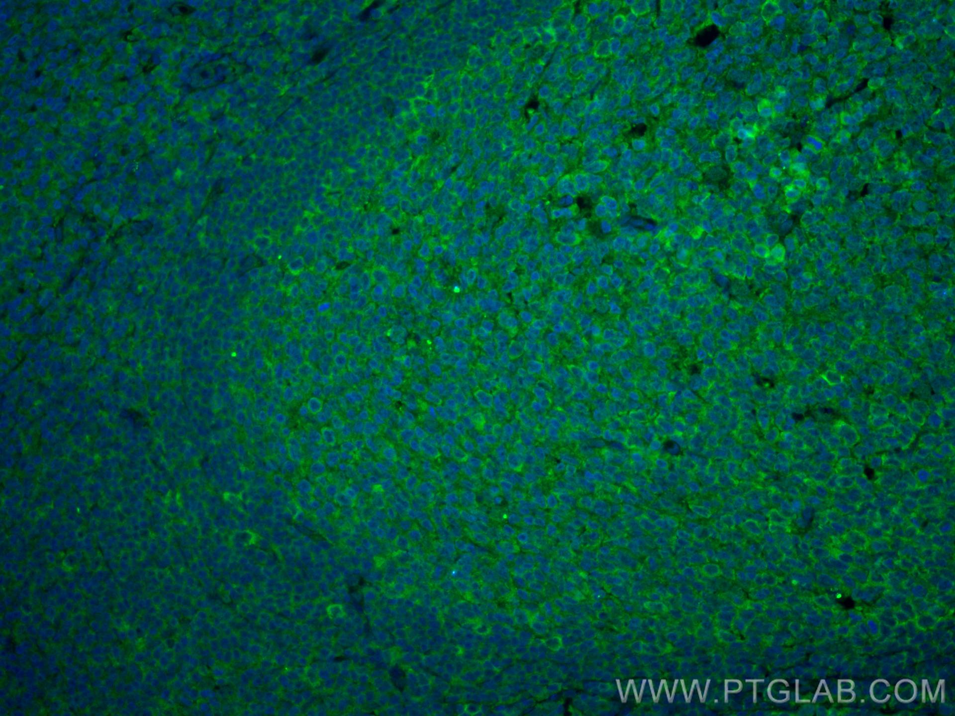 Immunofluorescence (IF) / fluorescent staining of human tonsillitis tissue using CoraLite® Plus 488-conjugated IL-28A Monoclonal an (CL488-60270)