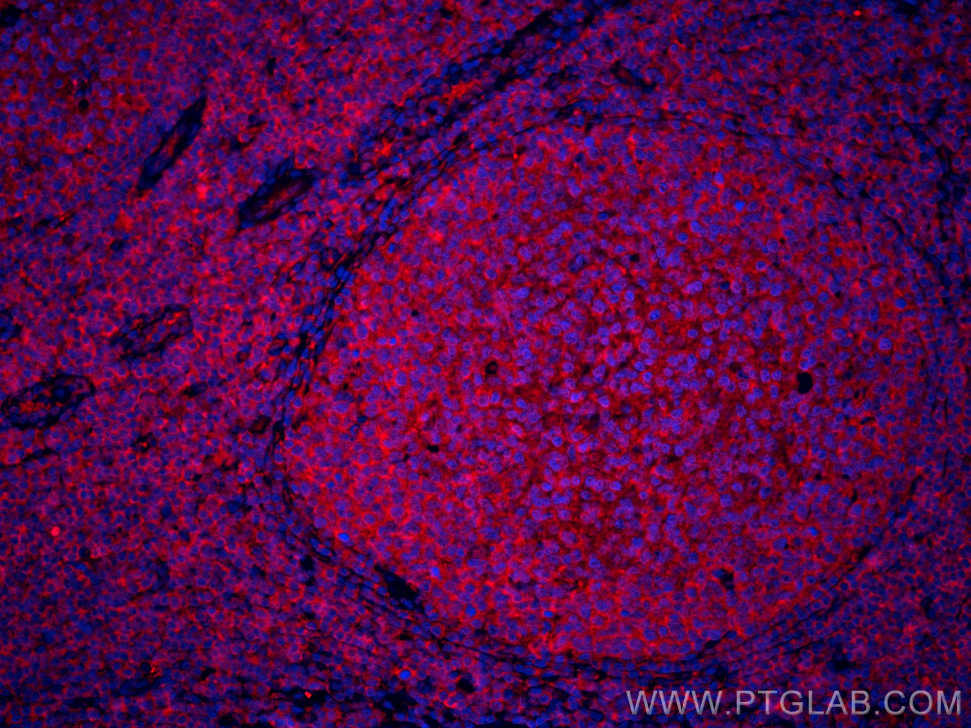 Immunofluorescence (IF) / fluorescent staining of human tonsillitis tissue using CoraLite®594-conjugated IL-28A Monoclonal antibody (CL594-60270)