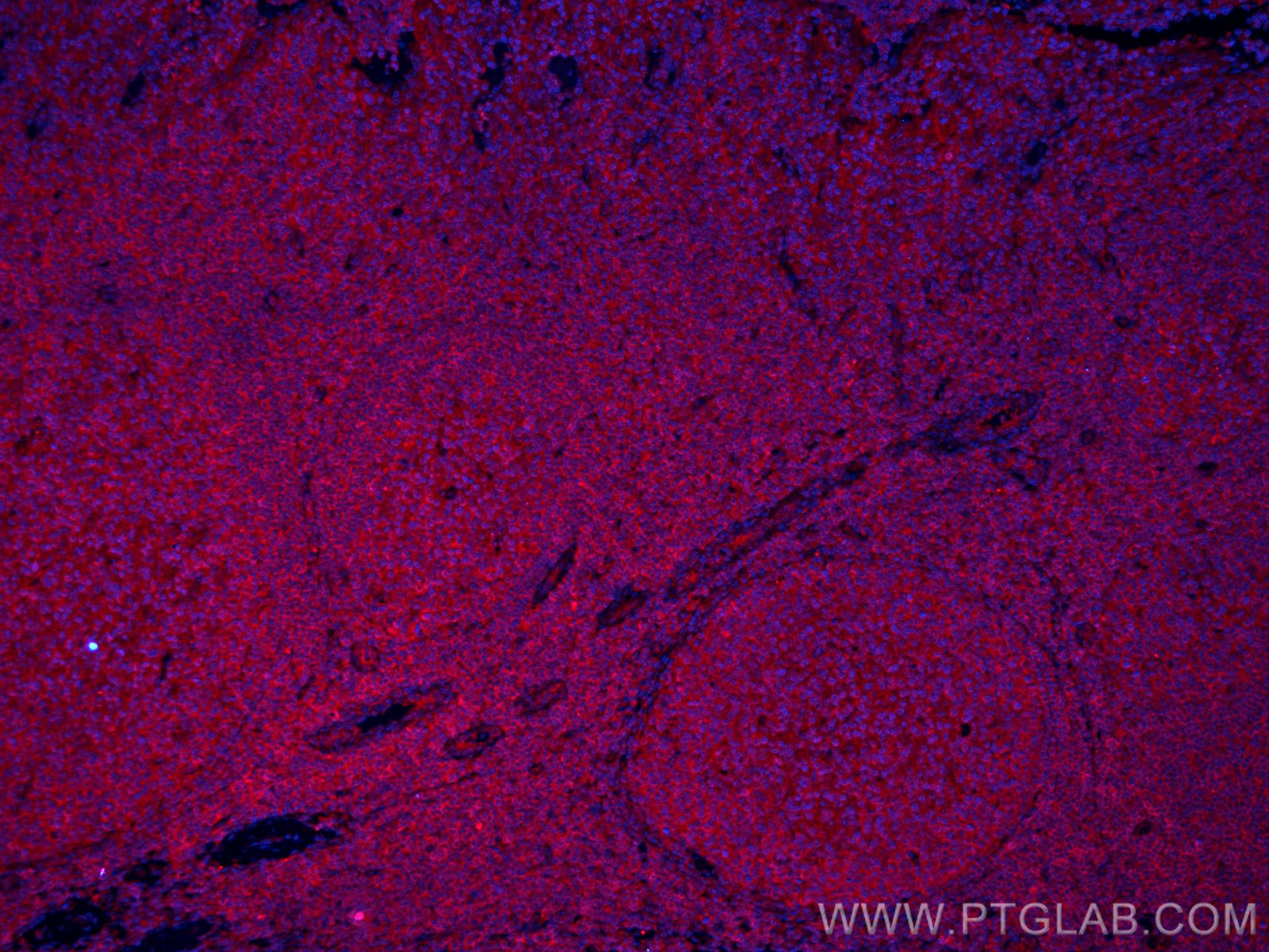IF Staining of human tonsillitis using CL594-60270