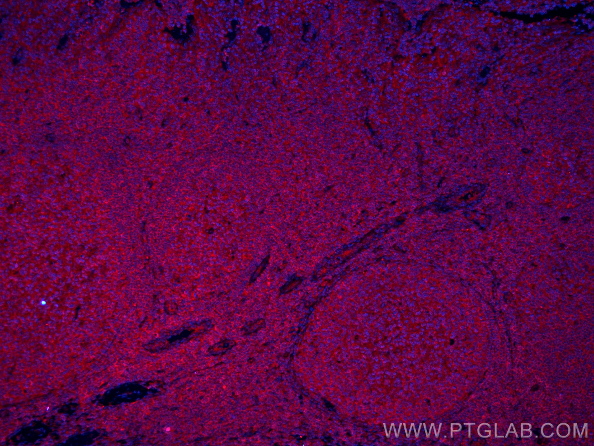 Immunofluorescence (IF) / fluorescent staining of human tonsillitis tissue using CoraLite®594-conjugated IL-28A Monoclonal antibody (CL594-60270)
