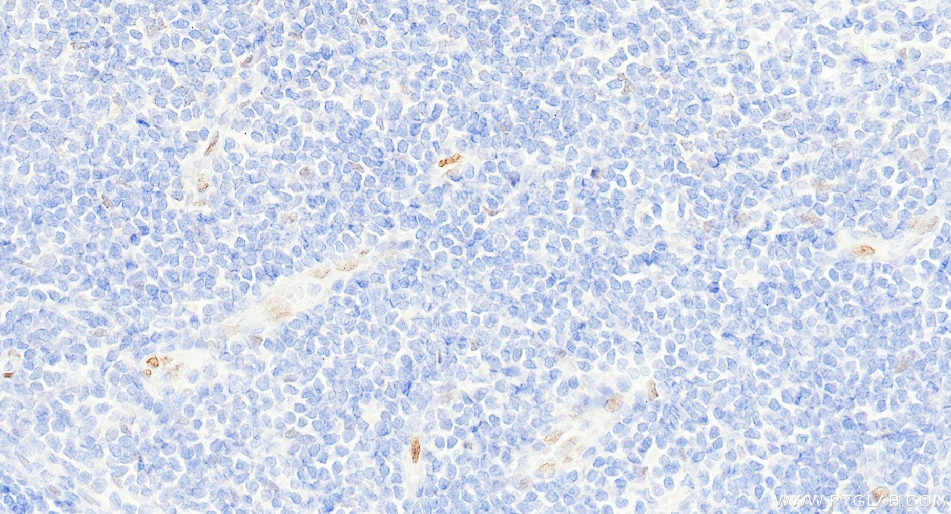 Immunohistochemistry (IHC) staining of human colon tissue using Anti-Human IL-33 Rabbit Recombinant Antibody (98364-2-RR)