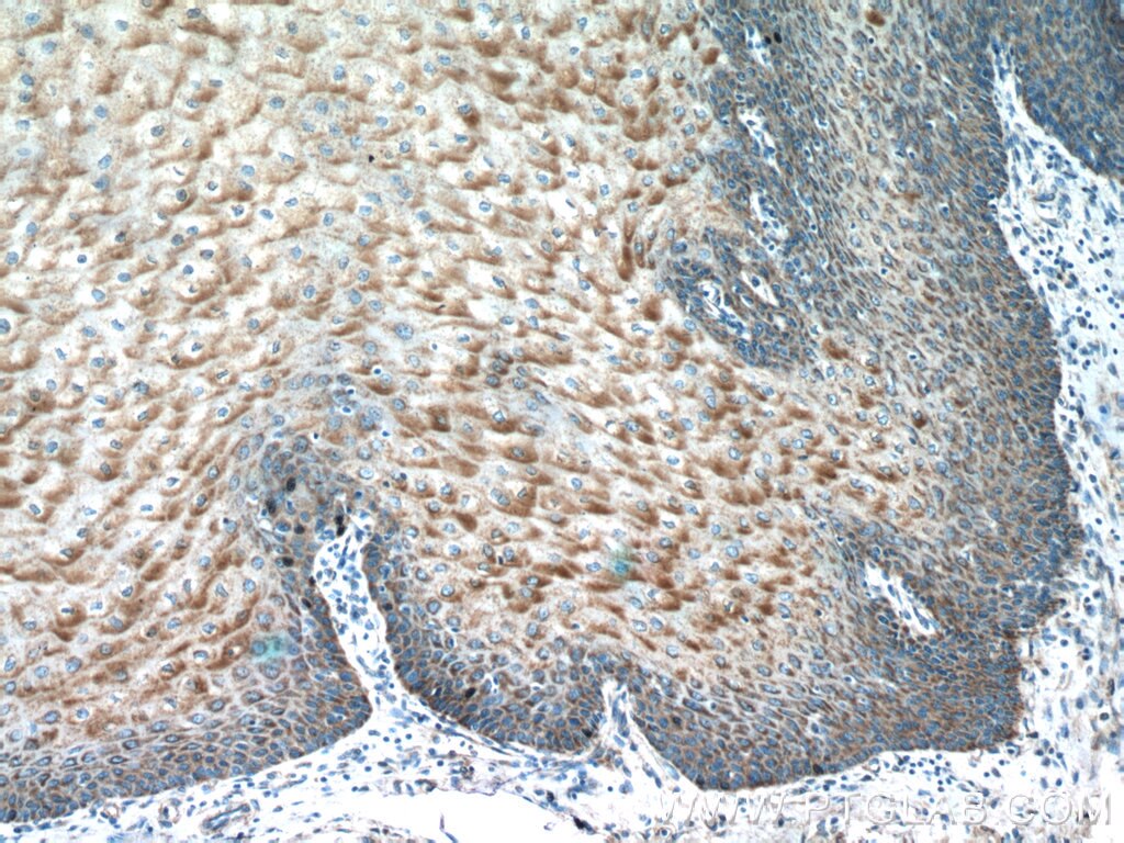 Immunohistochemistry (IHC) staining of human oesophagus tissue using IL-36 Gamma Polyclonal antibody (21255-1-AP)