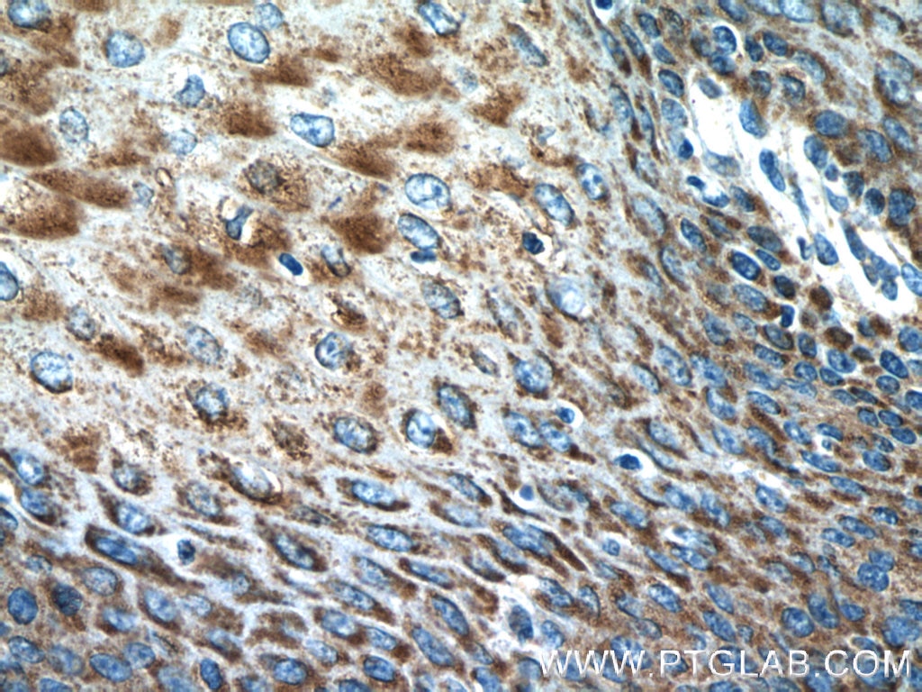Immunohistochemistry (IHC) staining of human oesophagus tissue using IL-36 Gamma Polyclonal antibody (21255-1-AP)