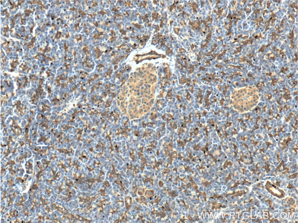 Immunohistochemistry (IHC) staining of human pancreas tissue using IL-36 Gamma Polyclonal antibody (24723-1-AP)