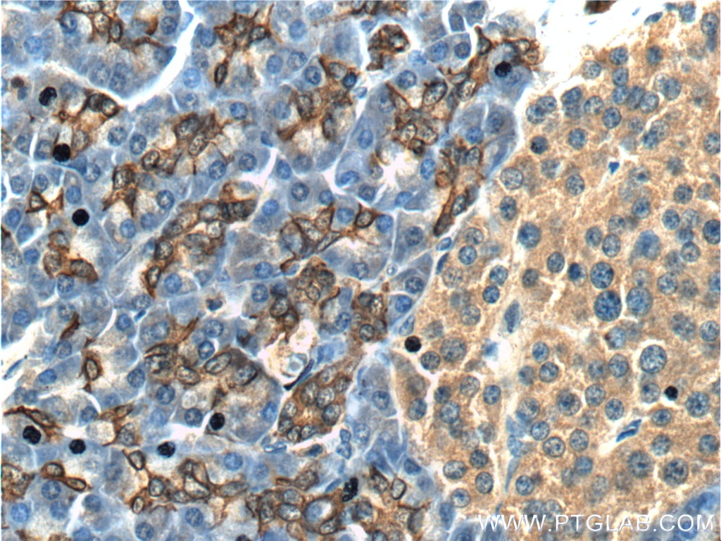 Immunohistochemistry (IHC) staining of human pancreas tissue using IL-36 Gamma Polyclonal antibody (24723-1-AP)
