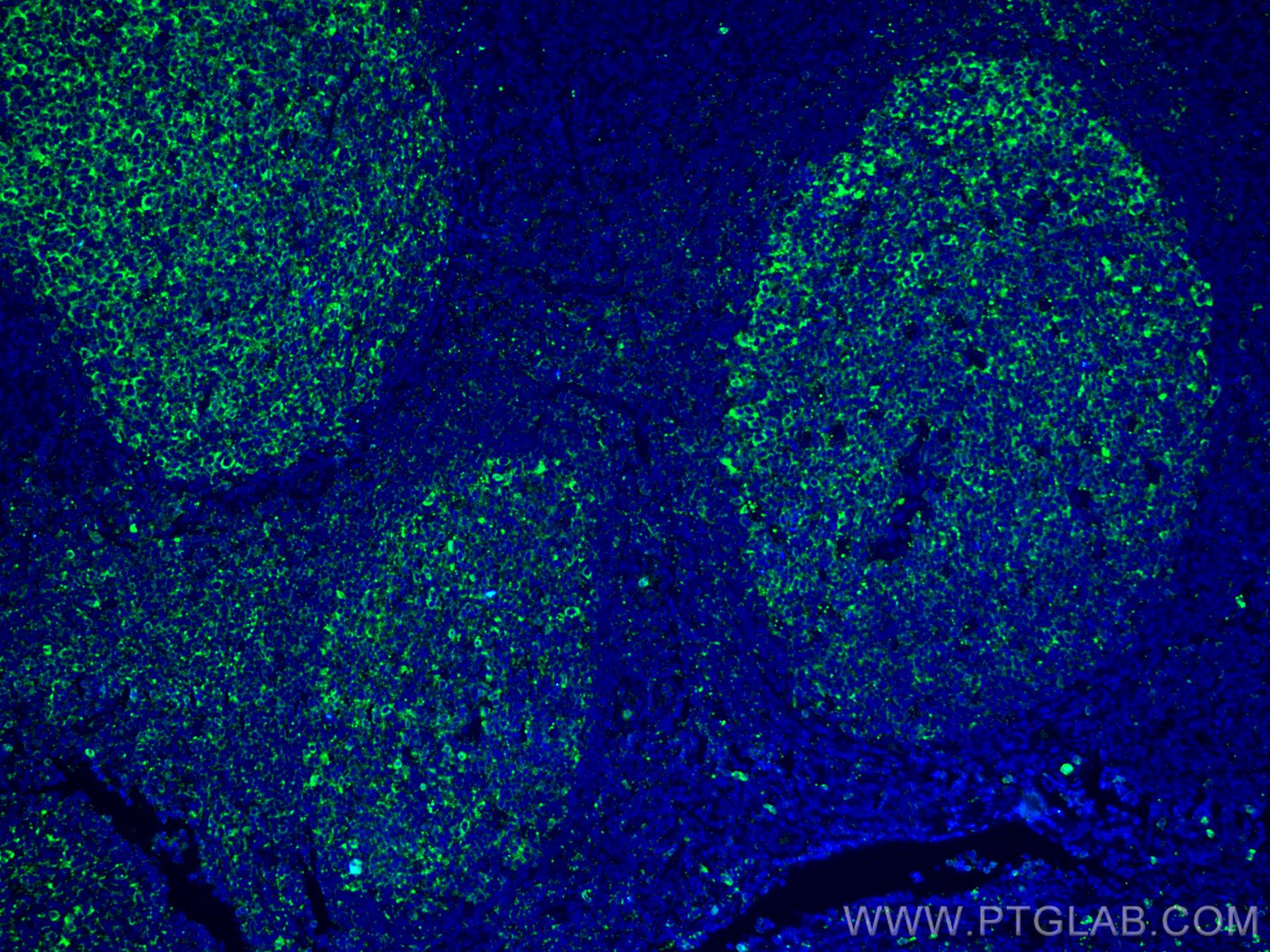 Immunofluorescence (IF) / fluorescent staining of human tonsillitis tissue using CoraLite® Plus 488-conjugated IL-36 Beta/IL-1F8 Mo (CL488-60290)