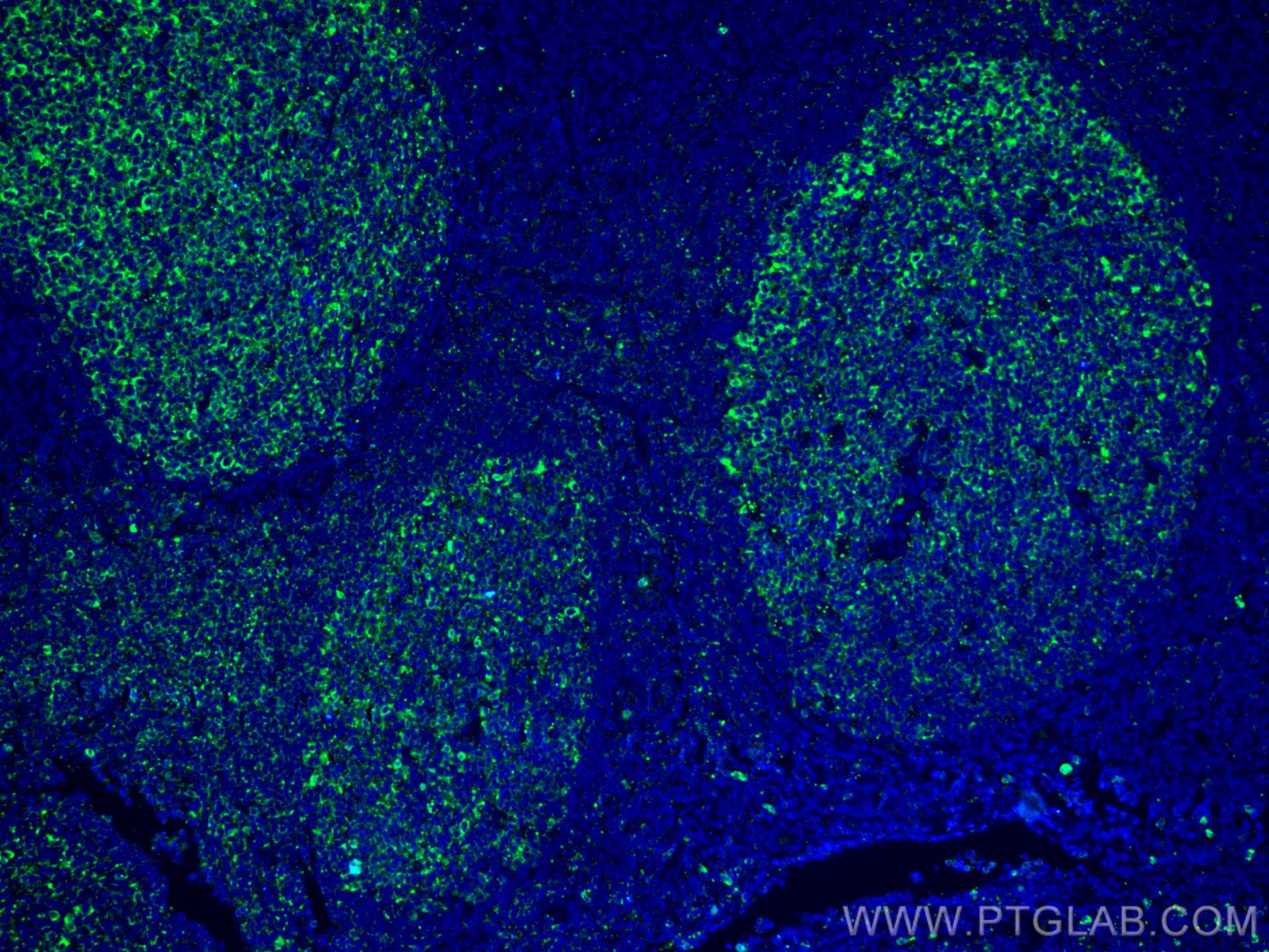 IF Staining of human tonsillitis using CL488-60290