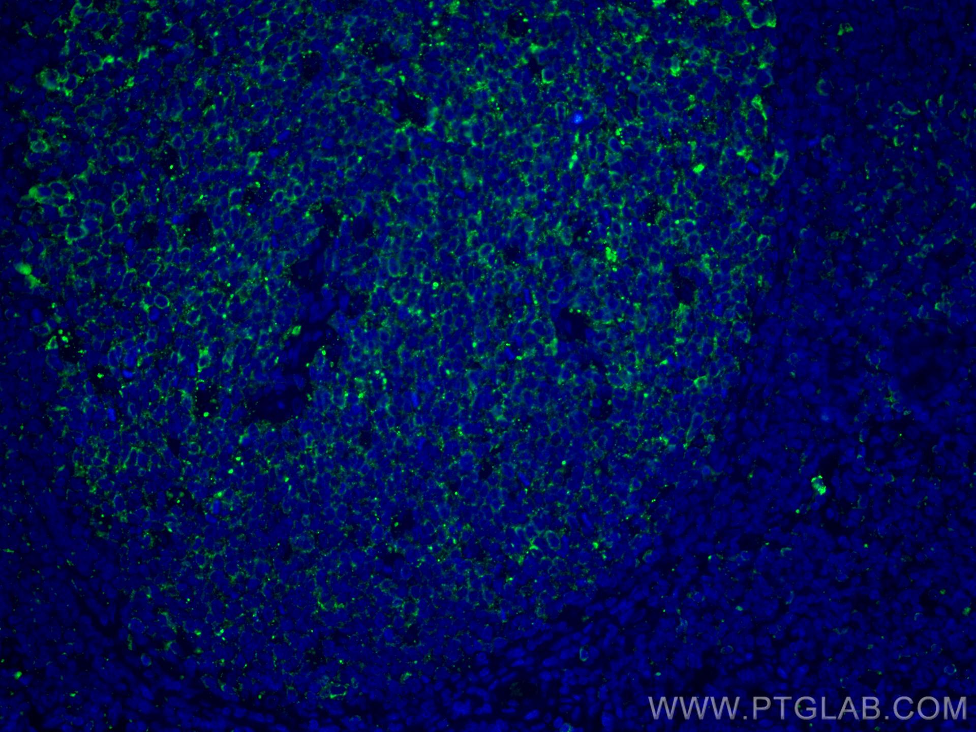IF Staining of human tonsillitis using CL488-60290