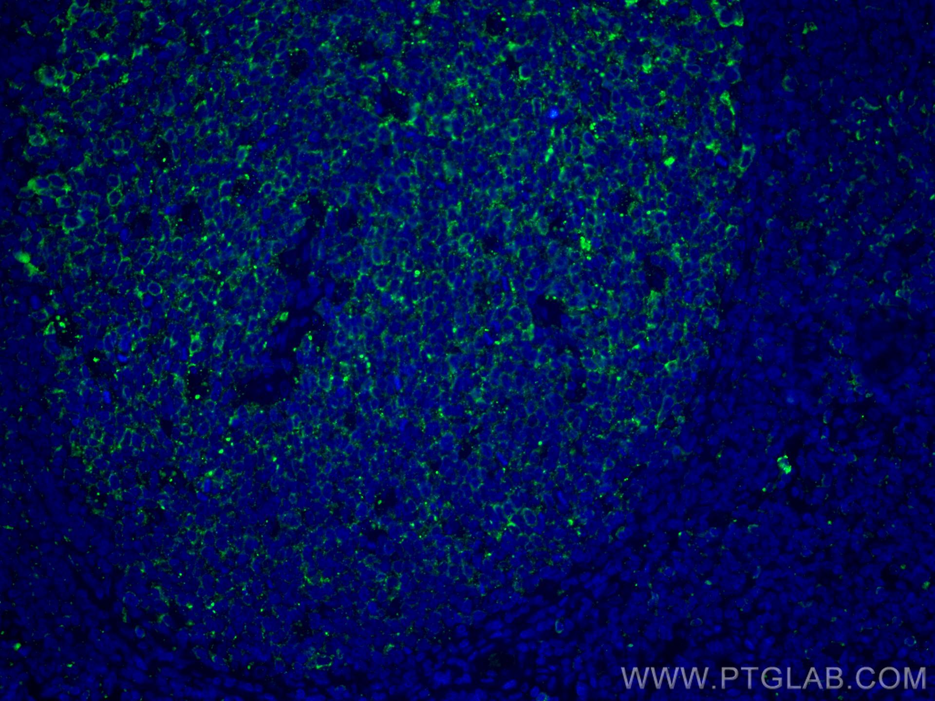 Immunofluorescence (IF) / fluorescent staining of human tonsillitis tissue using CoraLite® Plus 488-conjugated IL-36 Beta/IL-1F8 Mo (CL488-60290)