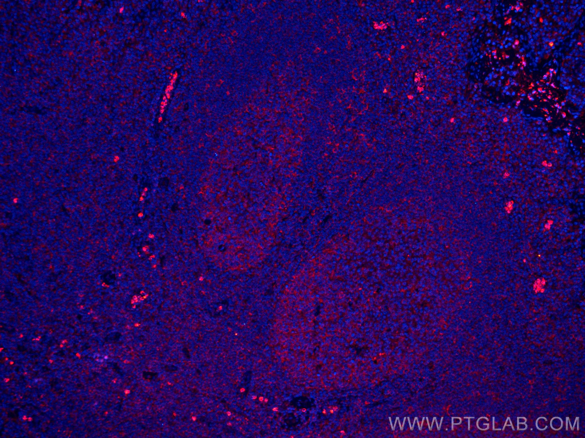 IF Staining of human tonsillitis using CL594-60290